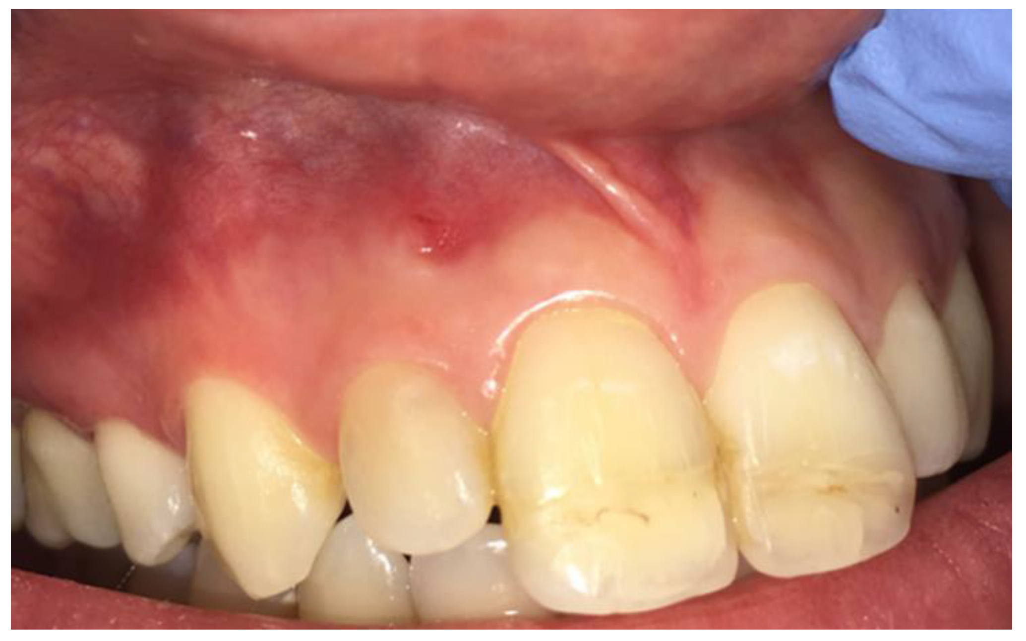 Dentistry 09 00027 g001