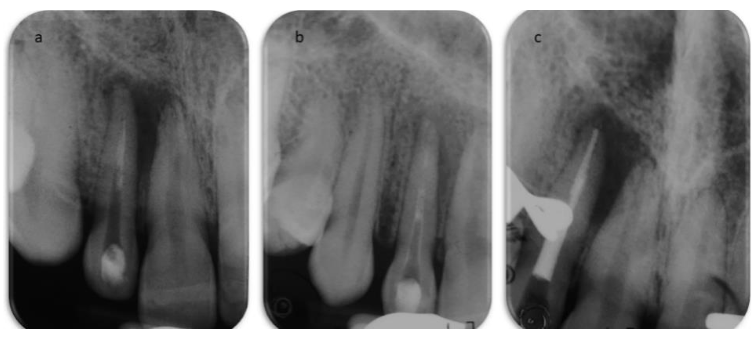 Dentistry 09 00027 g004