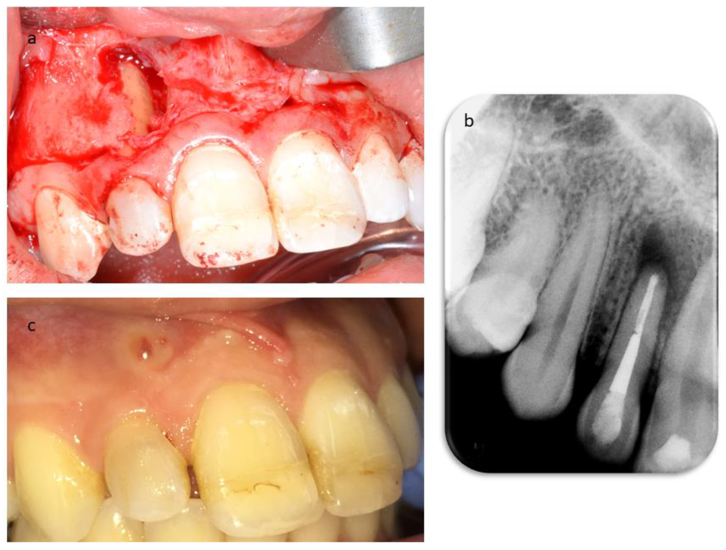 Dentistry 09 00027 g006
