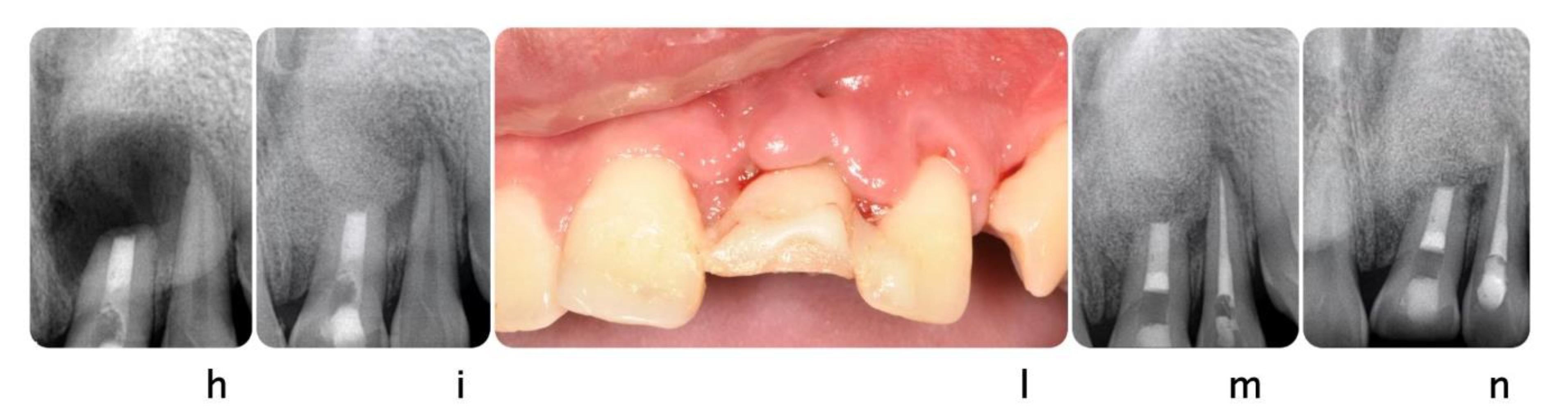 Dentistry 09 00033 g005b