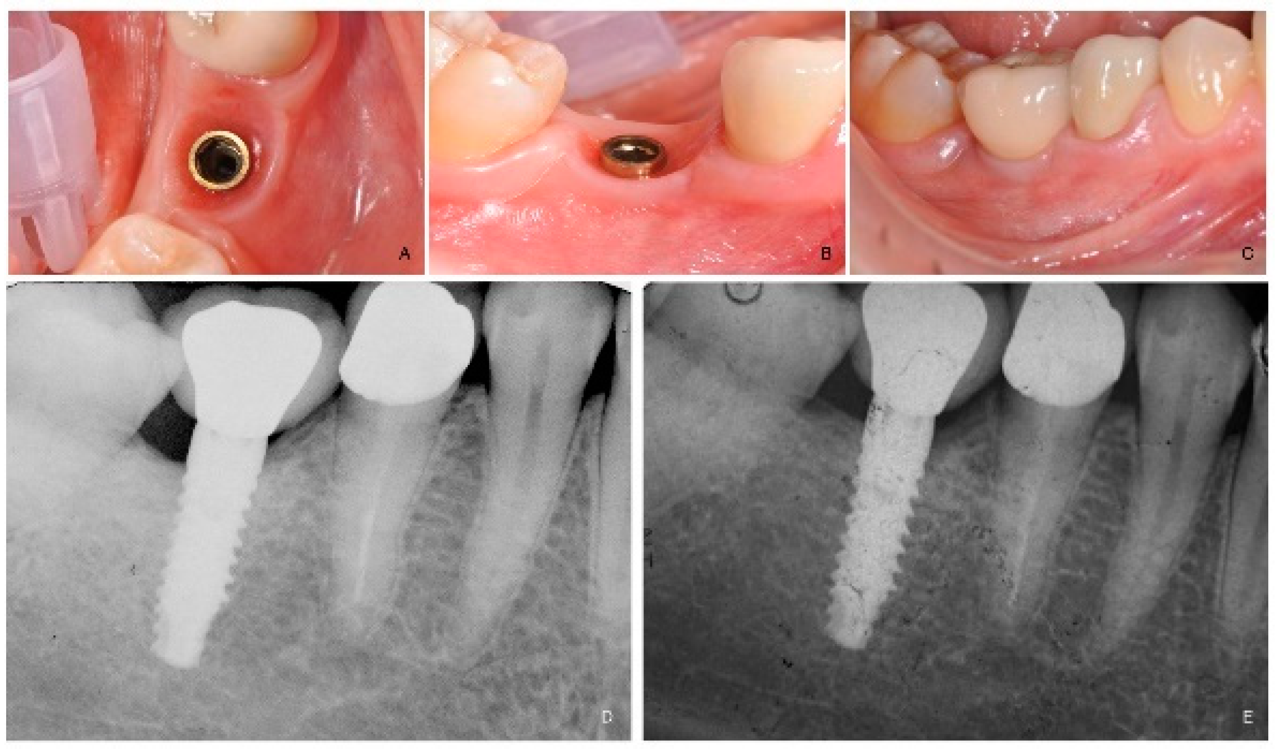 Dentistry 09 00035 g003 Dentistry 09 00035 g003