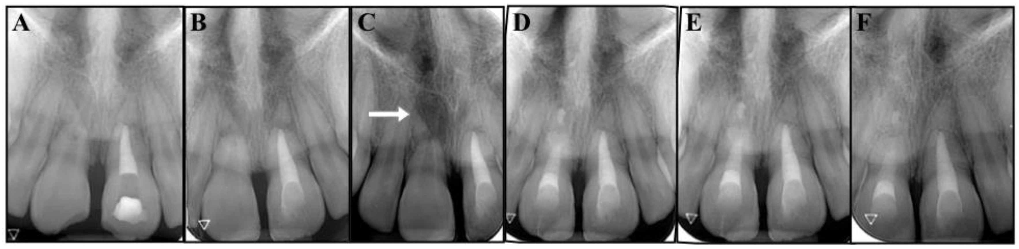 Dentistry 09 00039 g003