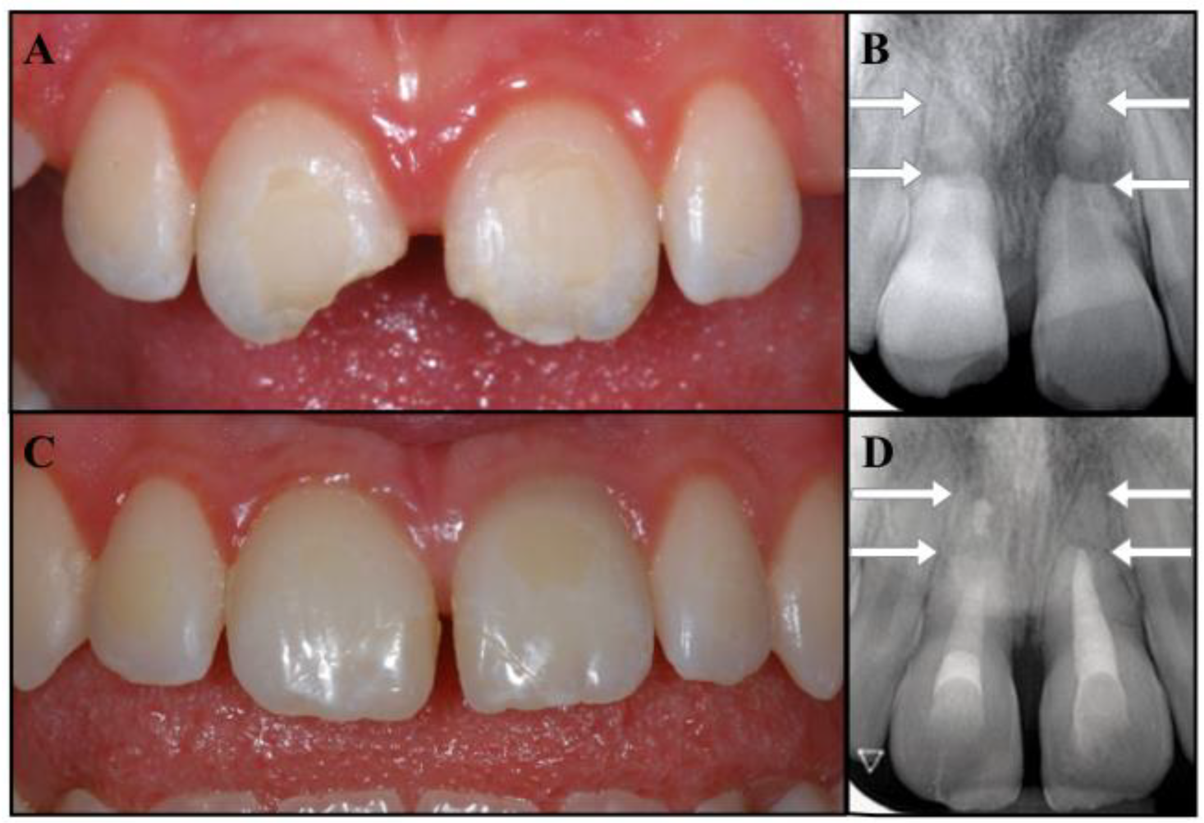 Dentistry 09 00039 g004