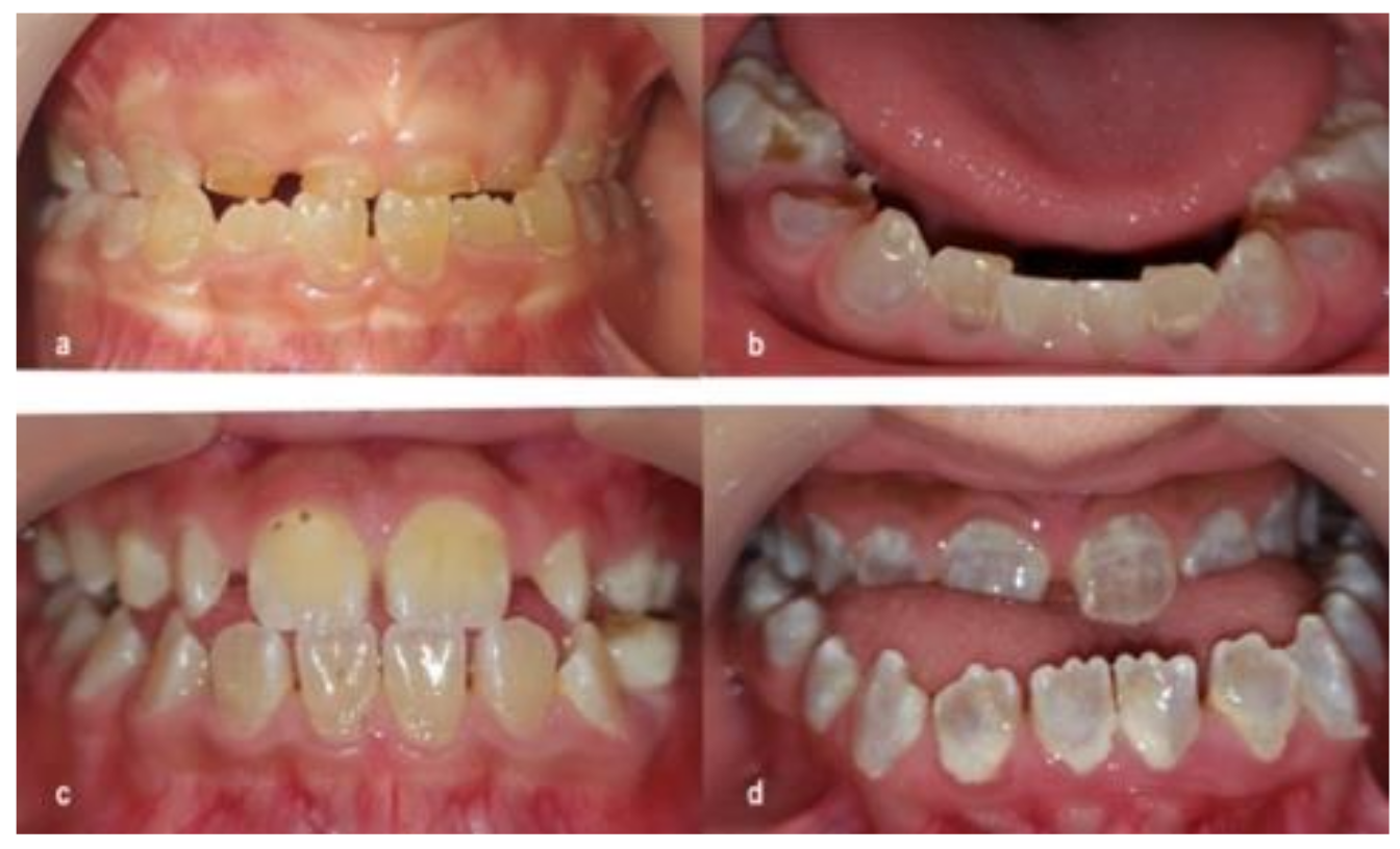 Dentistry 09 00049 g001