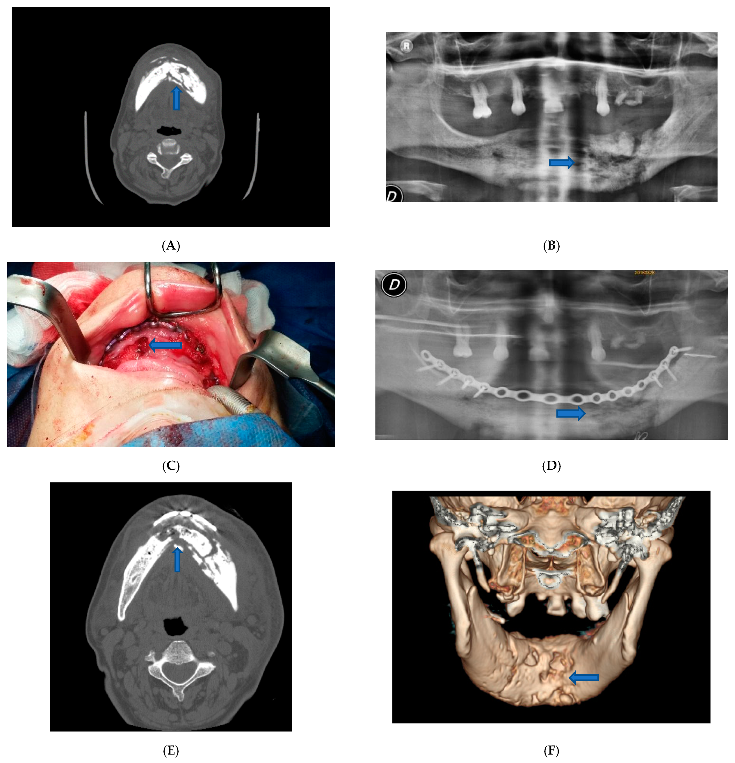 Dentistry 09 00050 g001 Dentistry 09 00050 g001