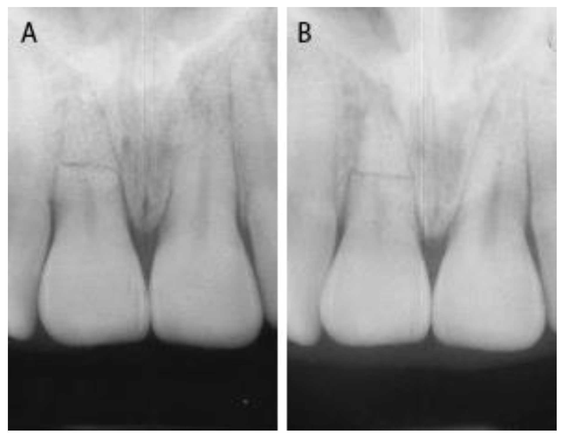 Dentistry 09 00055 g004