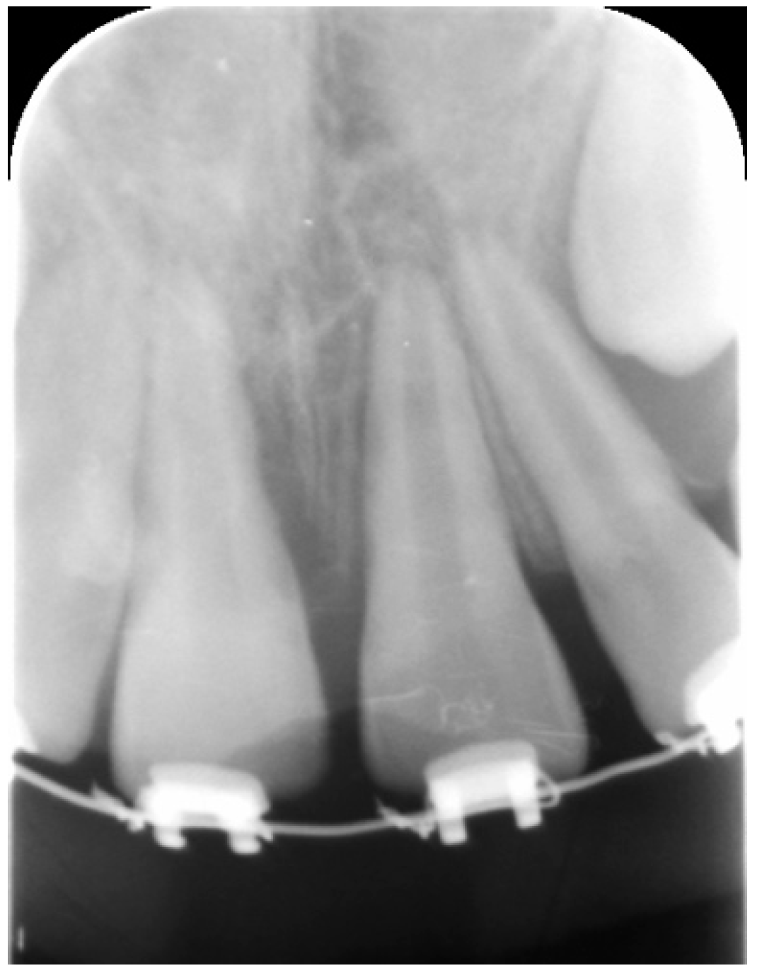 Dentistry 09 00072 g001 Dentistry 09 00072 g001