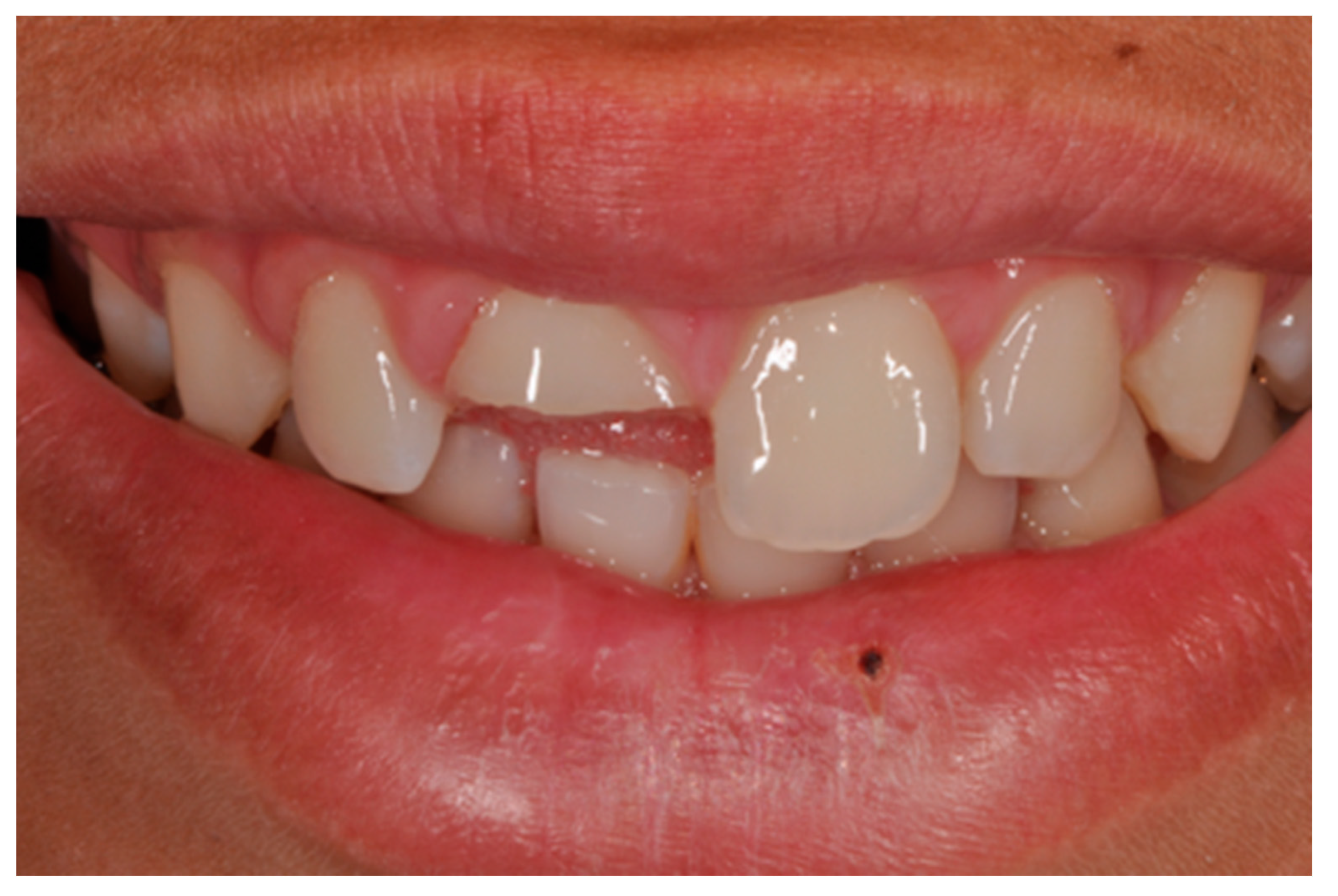 Dentistry 09 00079 g001