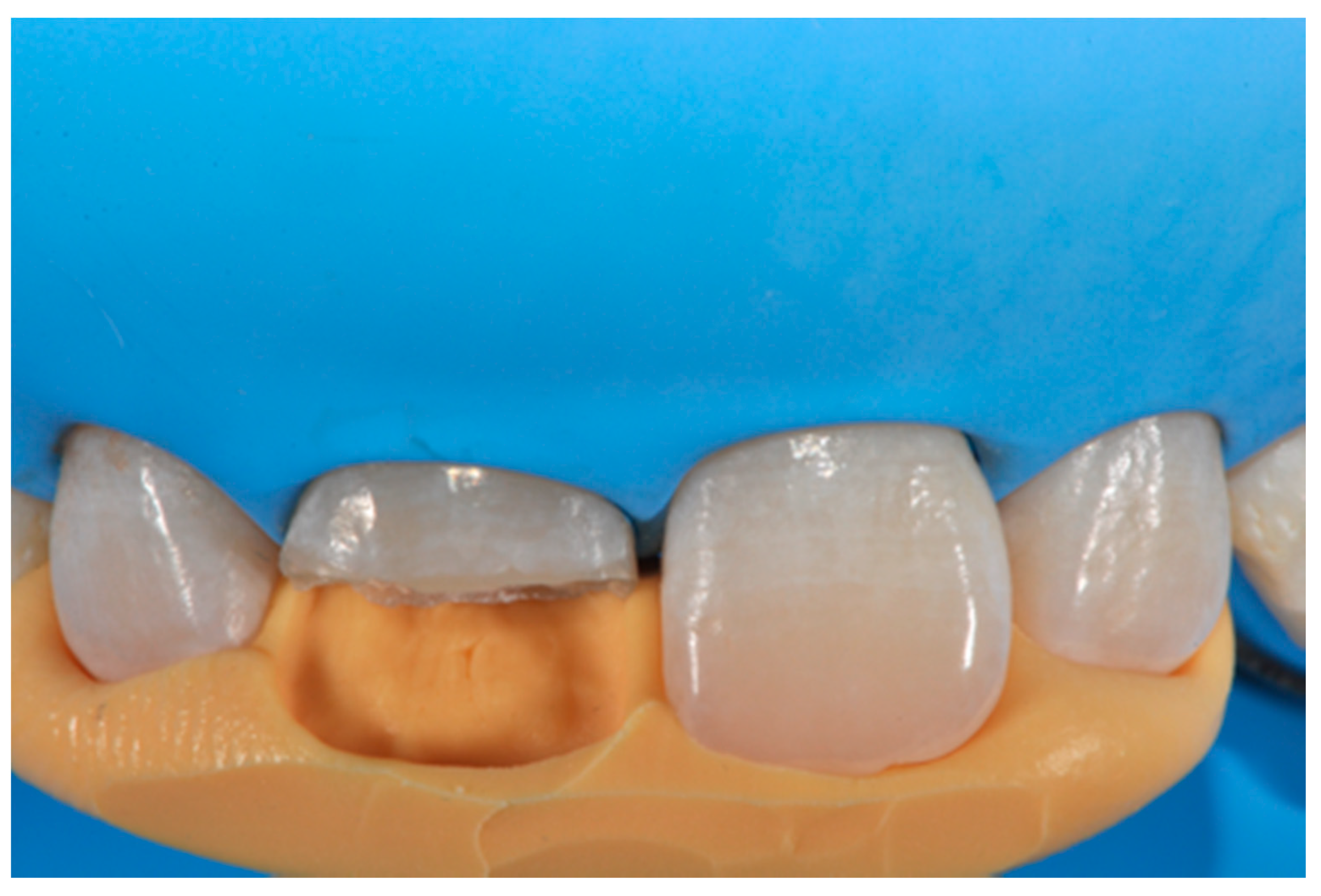 Dentistry 09 00079 g004