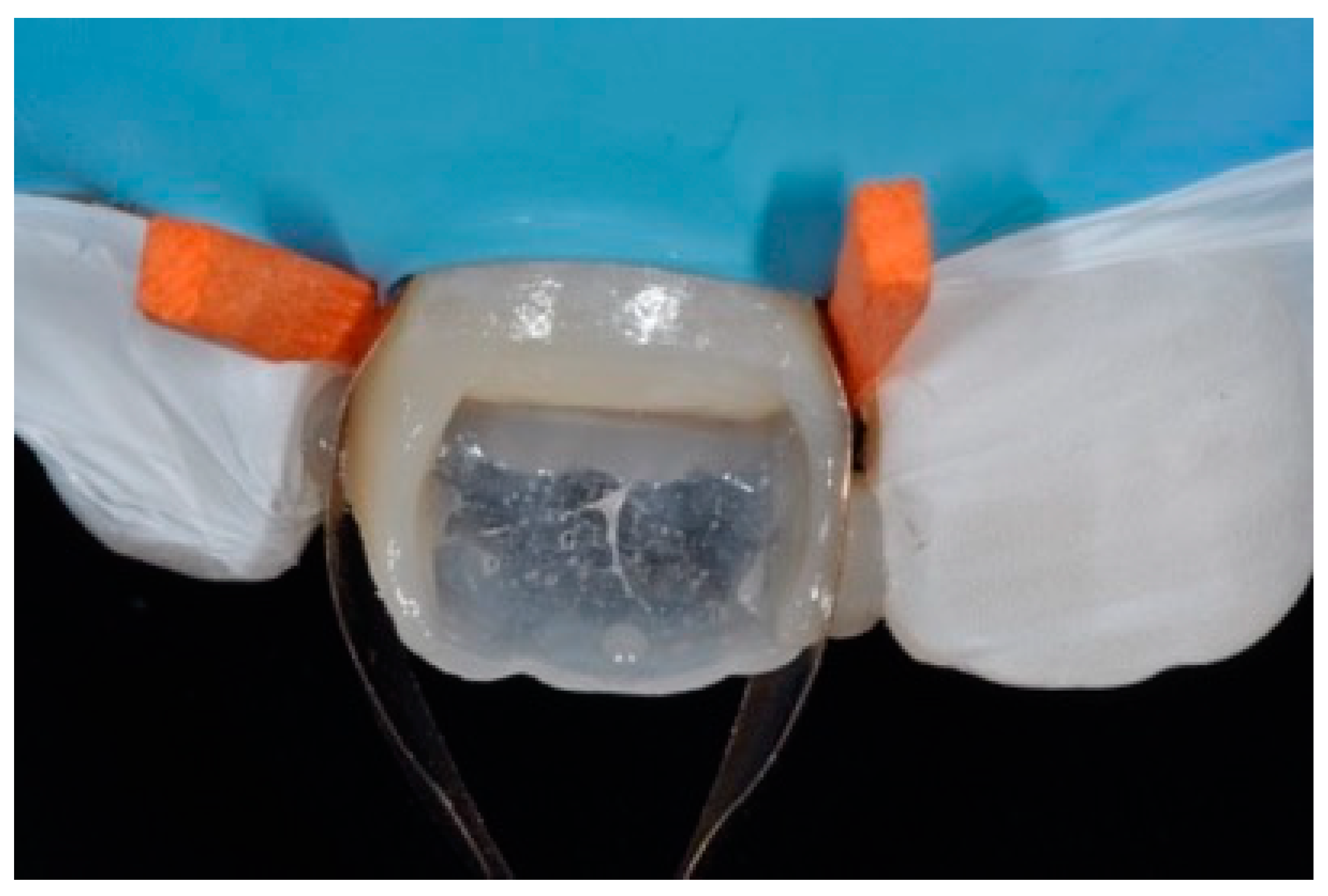 Dentistry 09 00079 g006