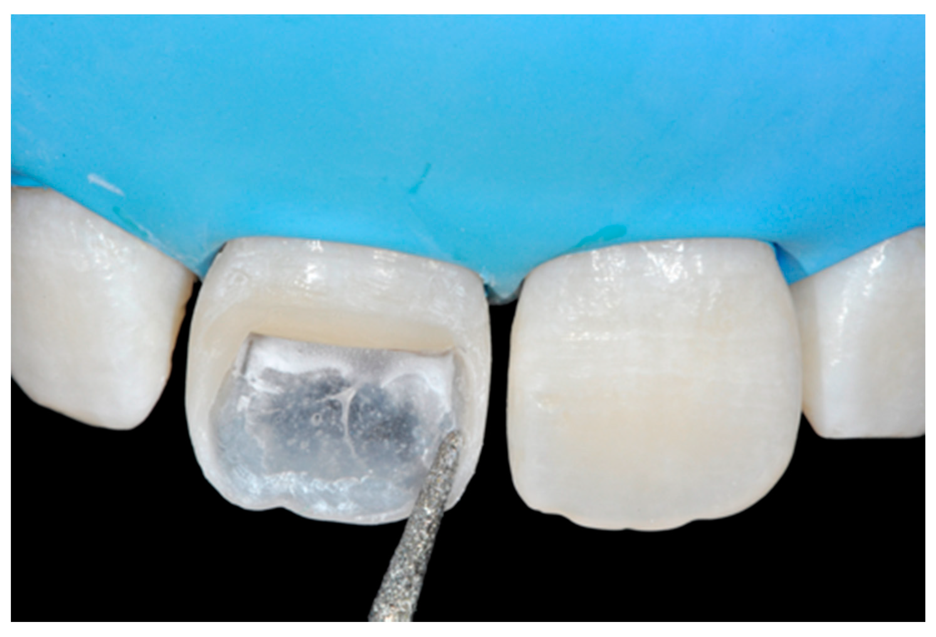 Dentistry 09 00079 g008