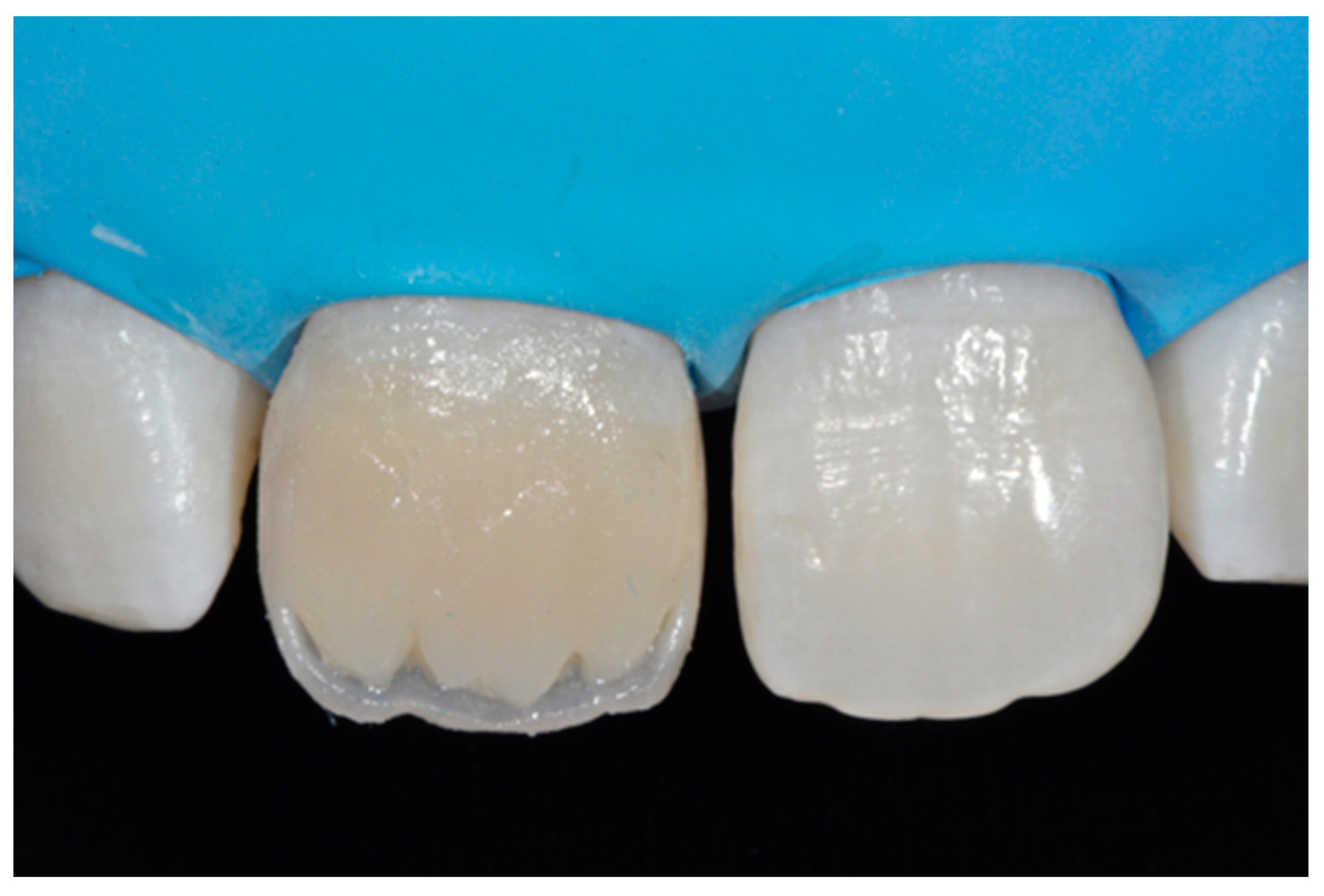 Dentistry 09 00079 g011