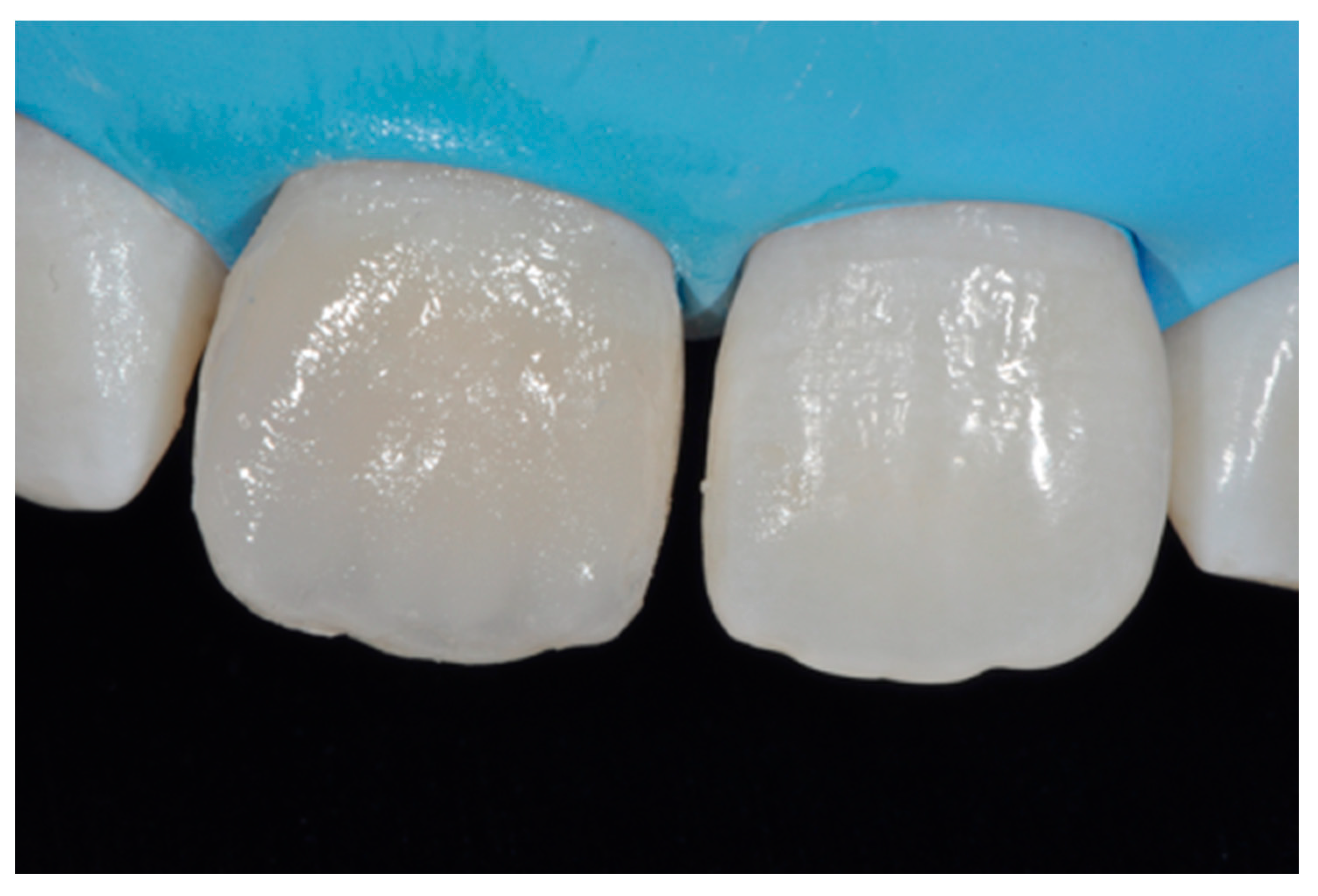 Dentistry 09 00079 g012