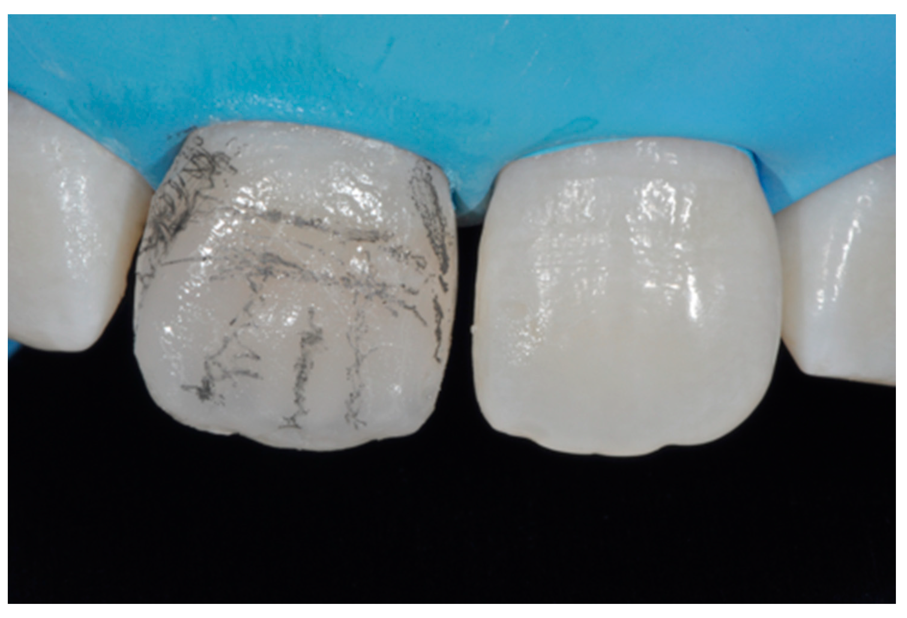 Dentistry 09 00079 g013