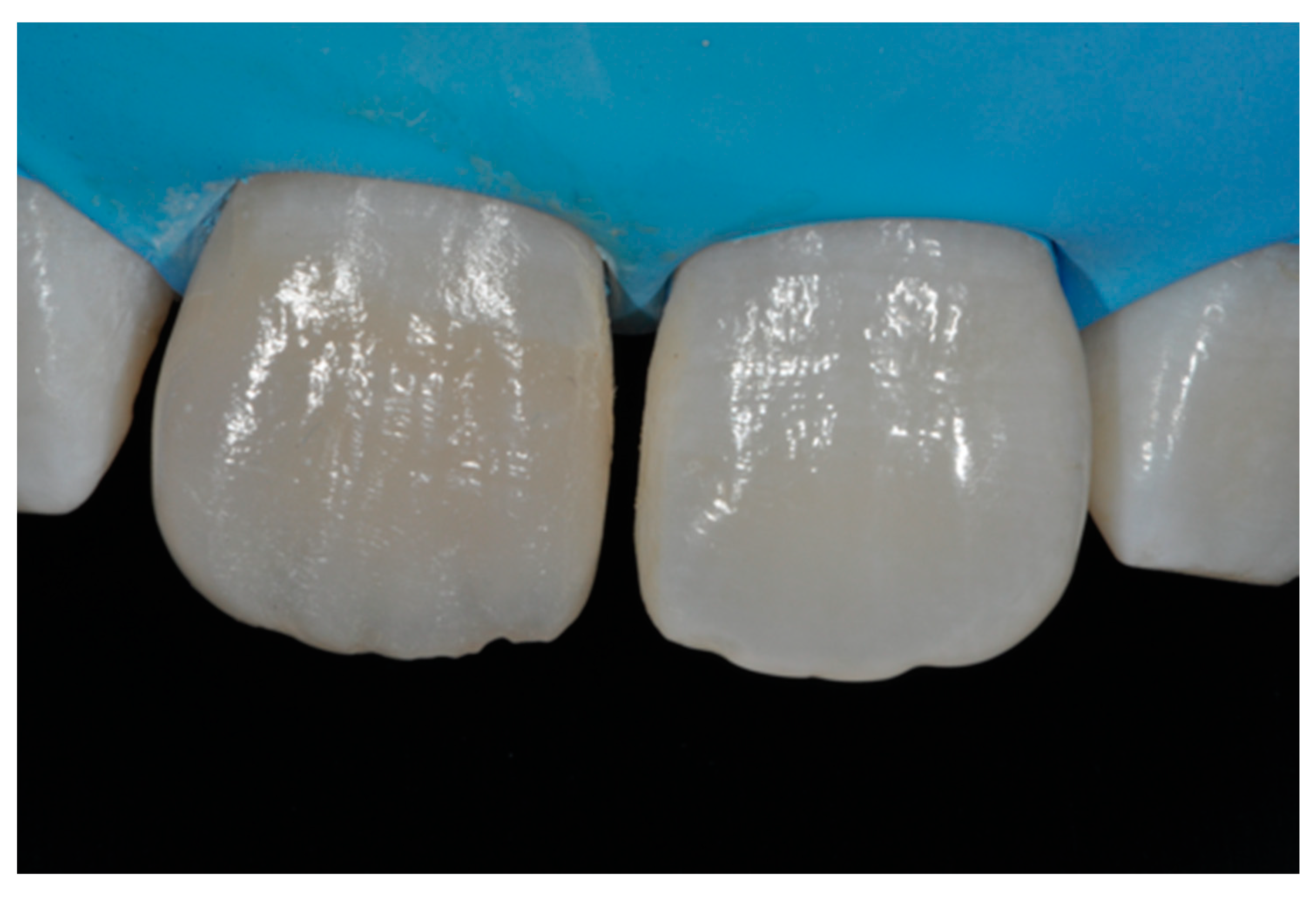 Dentistry 09 00079 g014