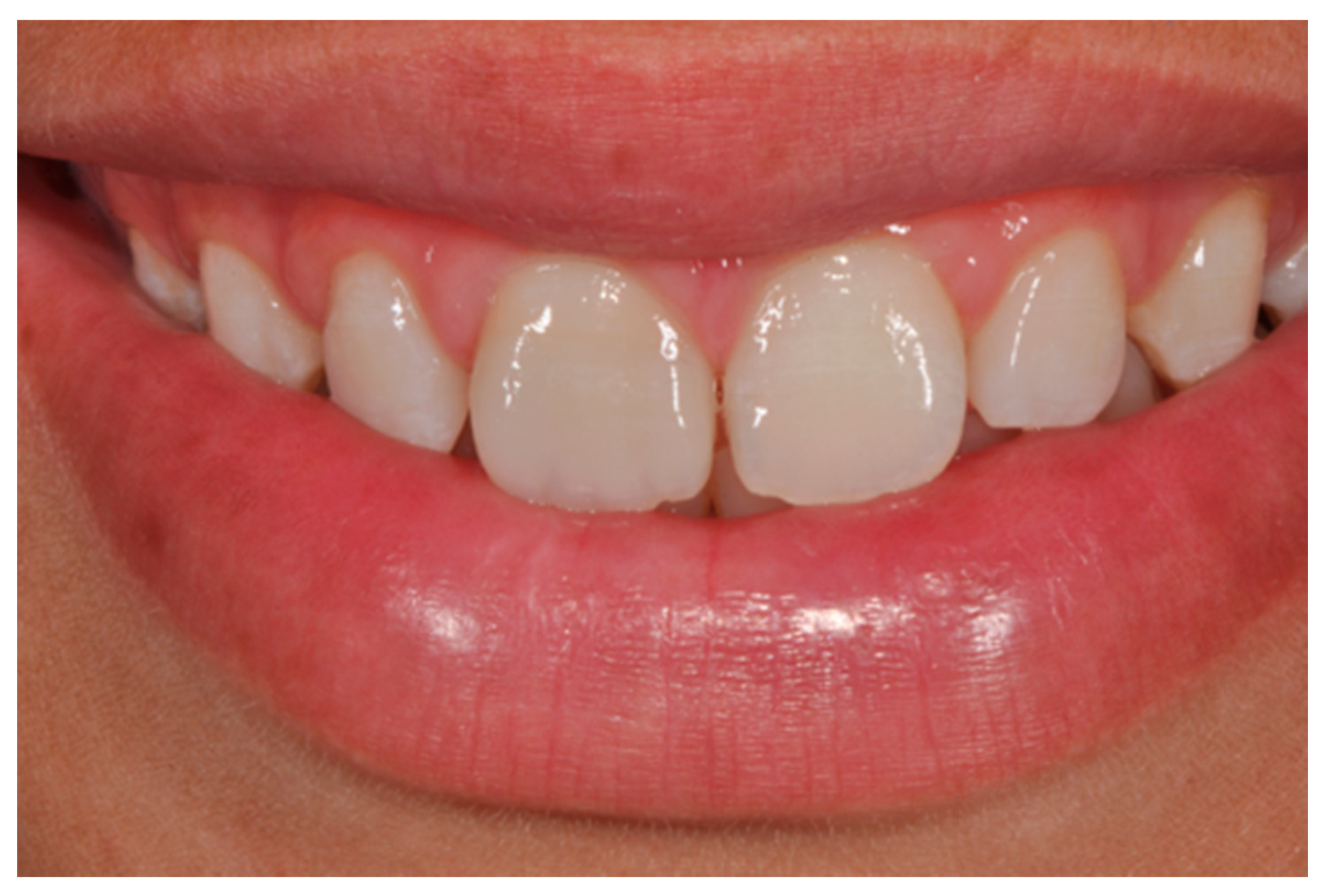 Dentistry 09 00079 g015