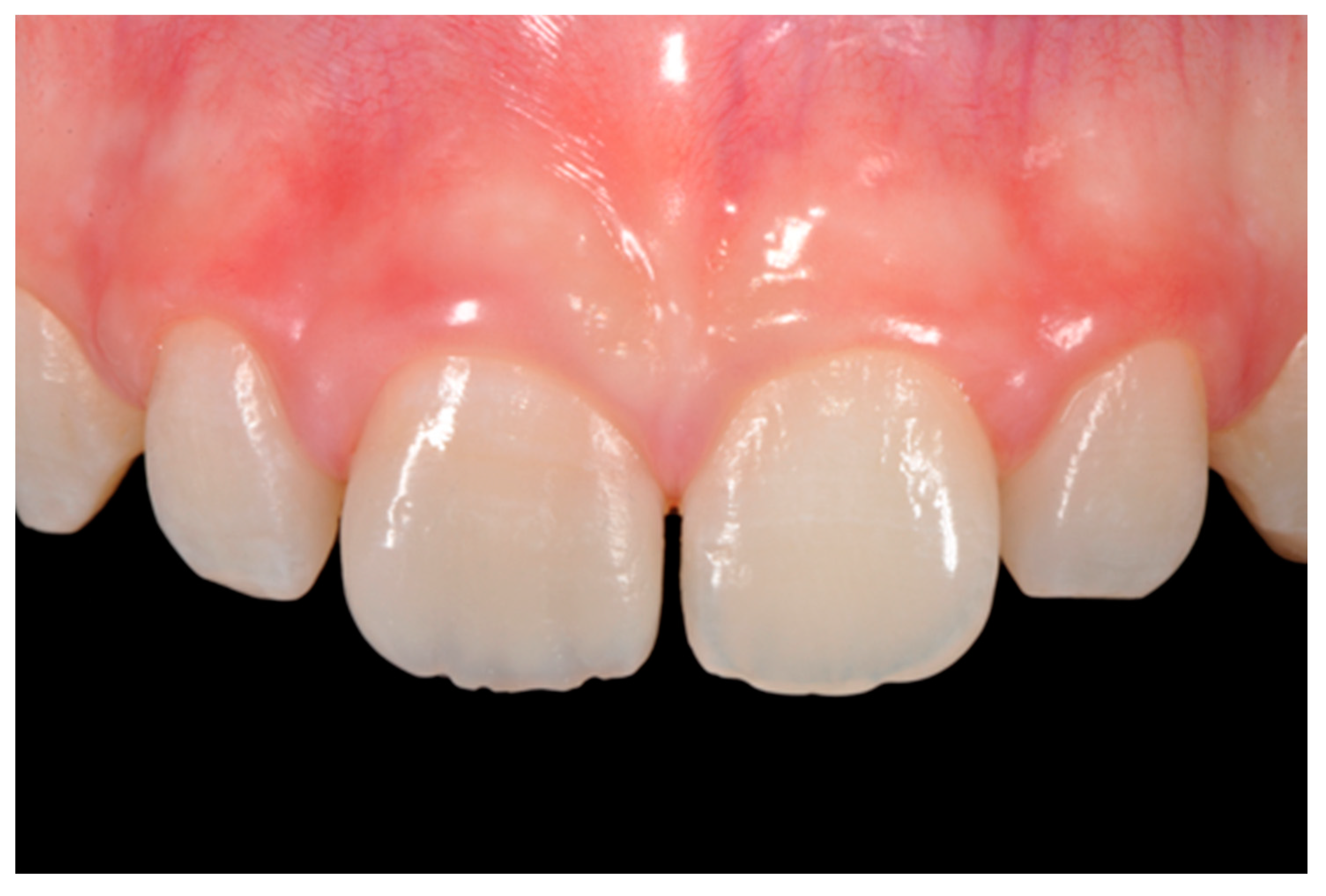 Dentistry 09 00079 g016