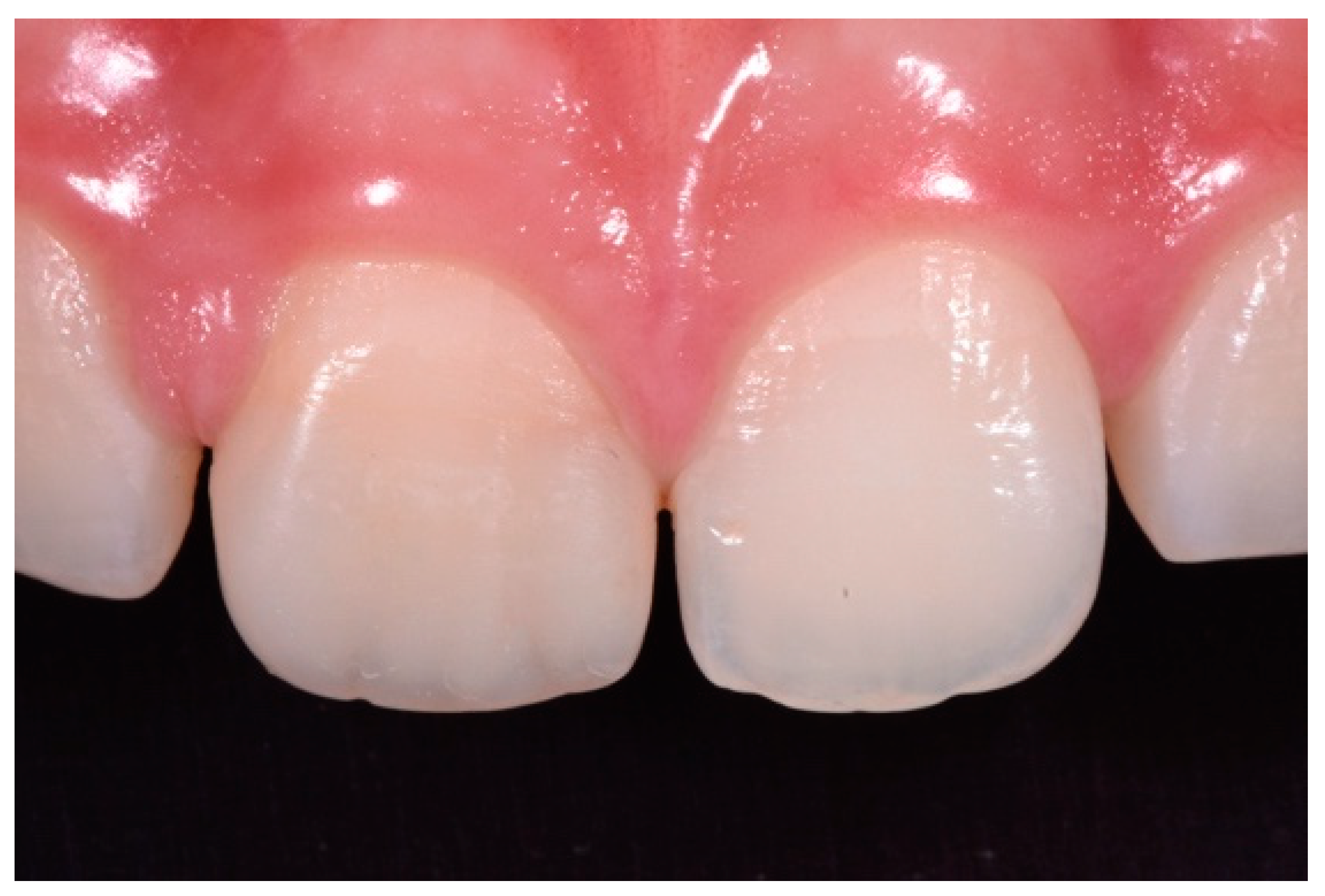 Dentistry 09 00079 g018