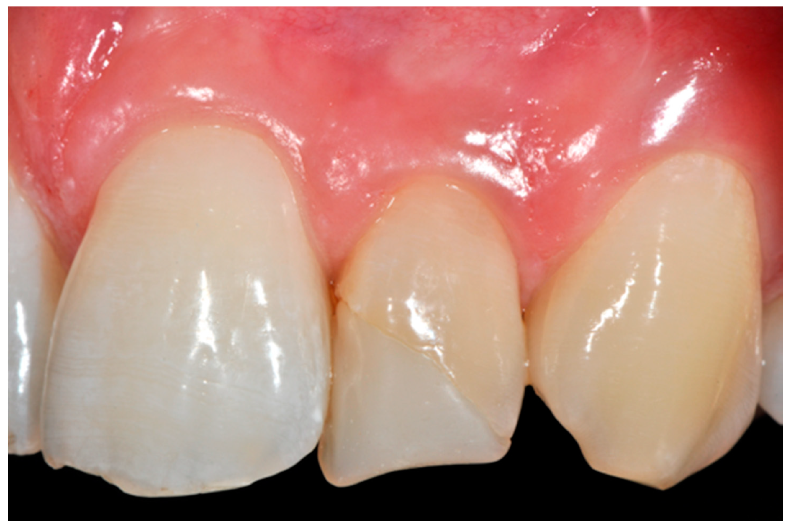 Dentistry 09 00079 g020