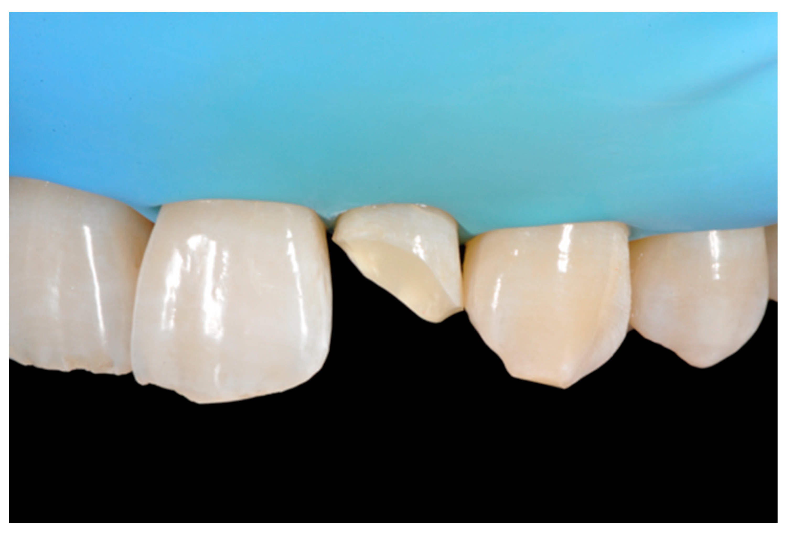 Dentistry 09 00079 g022