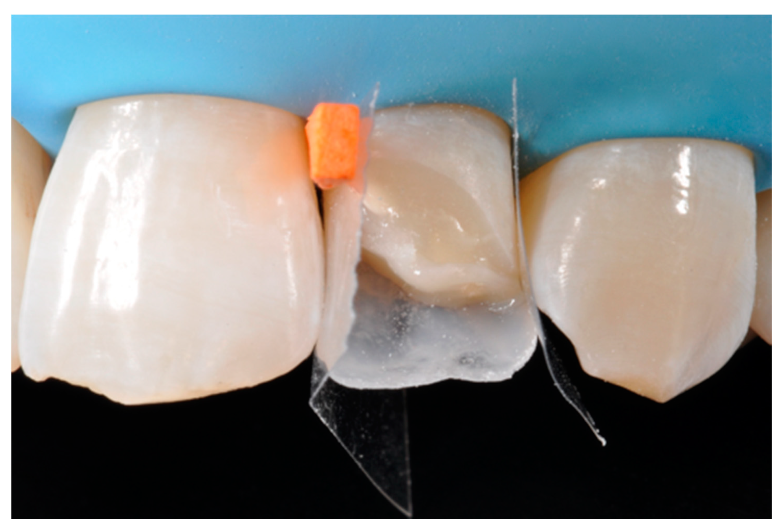 Dentistry 09 00079 g023