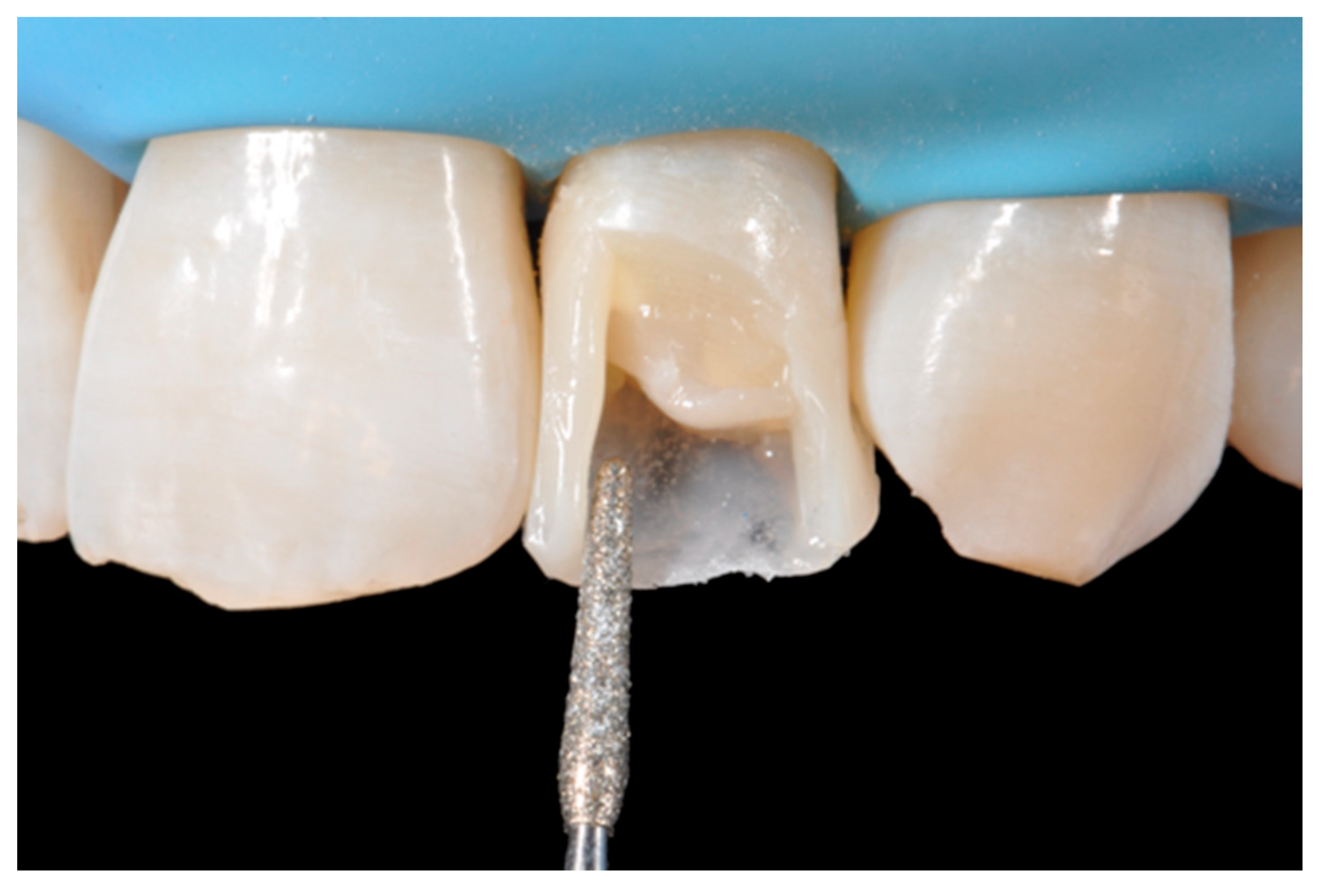 Dentistry 09 00079 g024