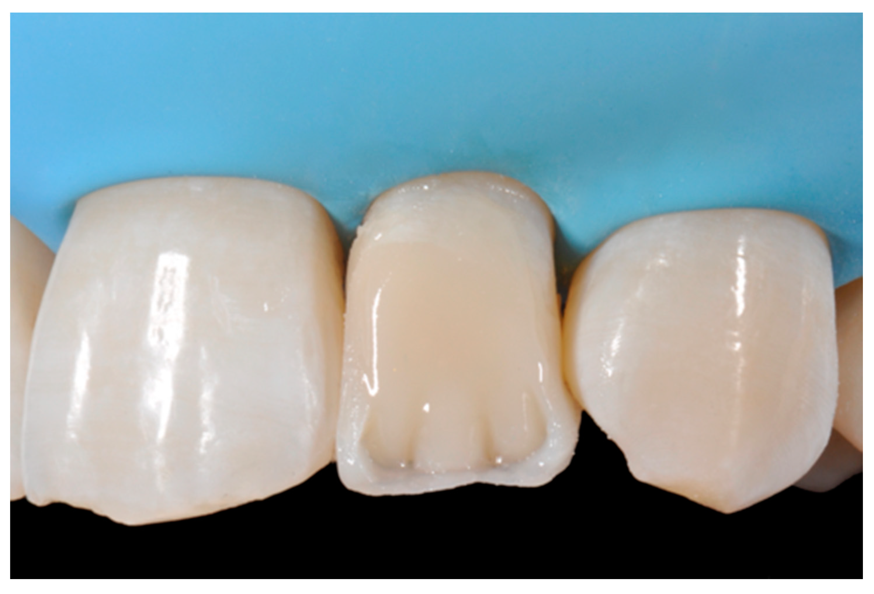 Dentistry 09 00079 g025