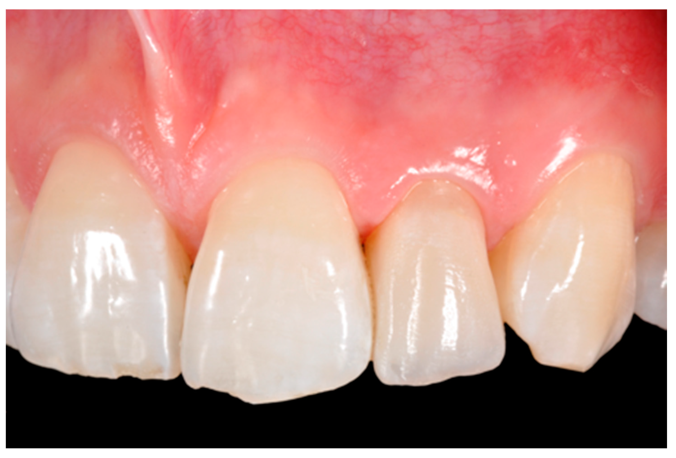 Dentistry 09 00079 g028