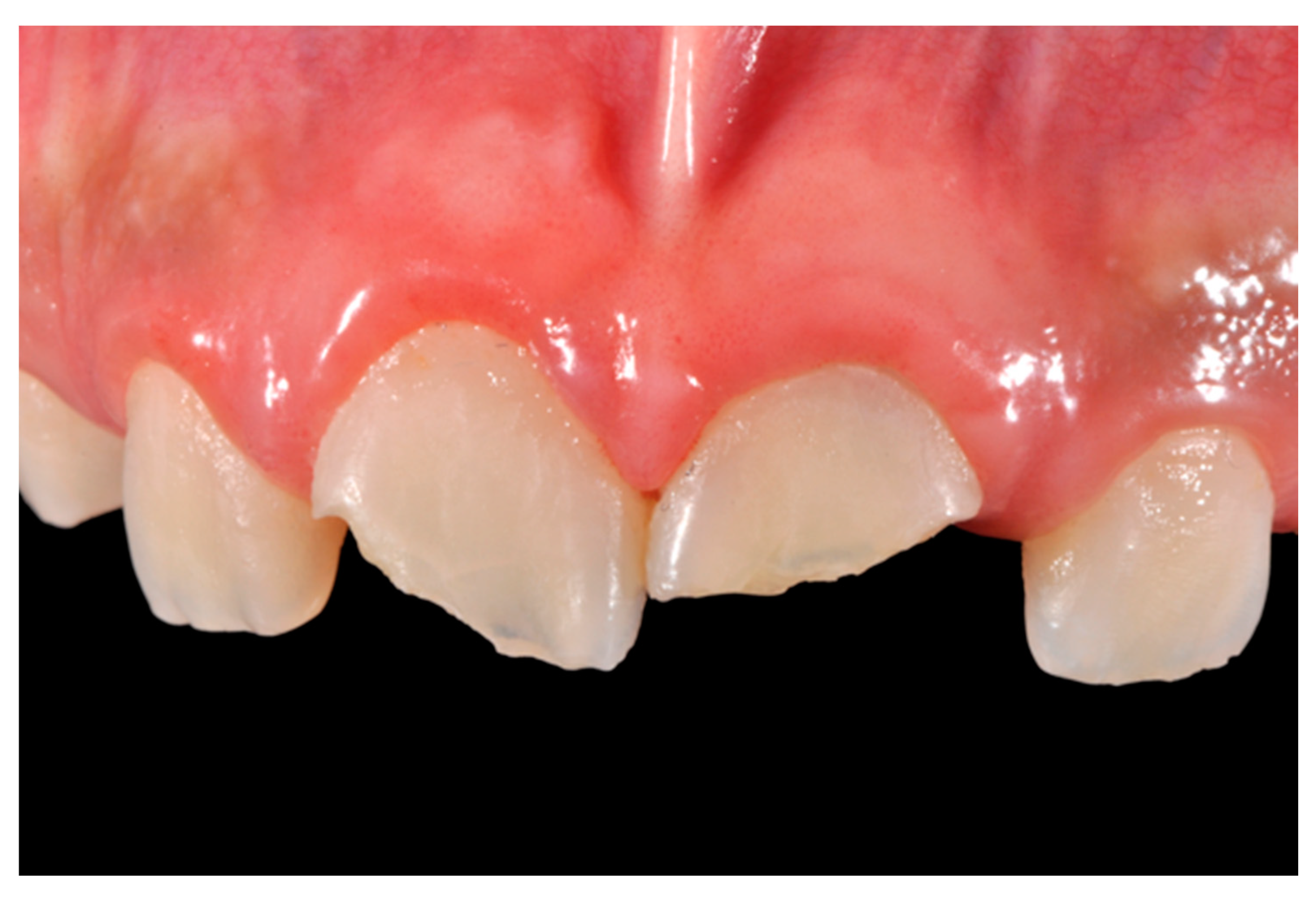 Dentistry 09 00079 g030