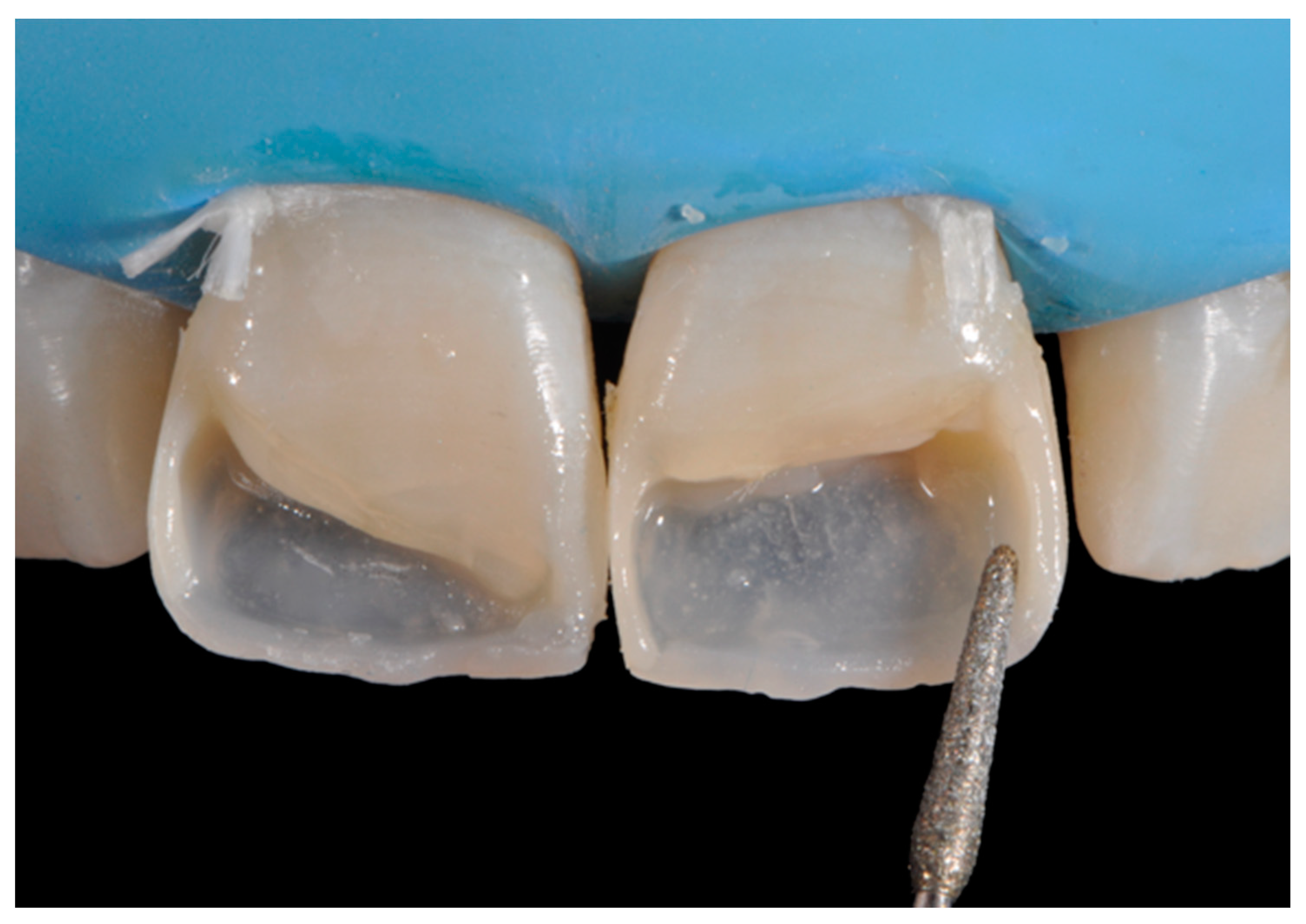 Dentistry 09 00079 g033