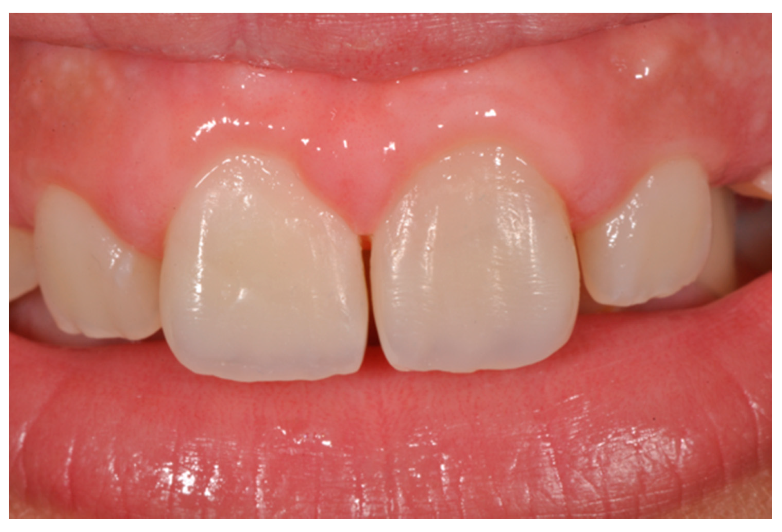 Dentistry 09 00079 g038