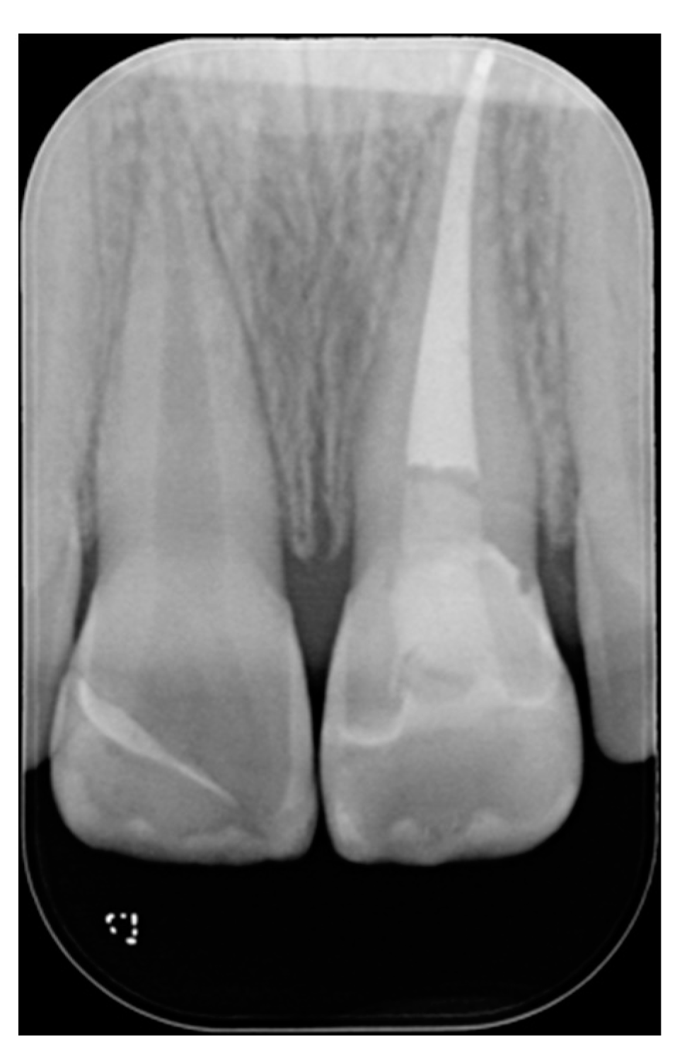 Dentistry 09 00079 g039