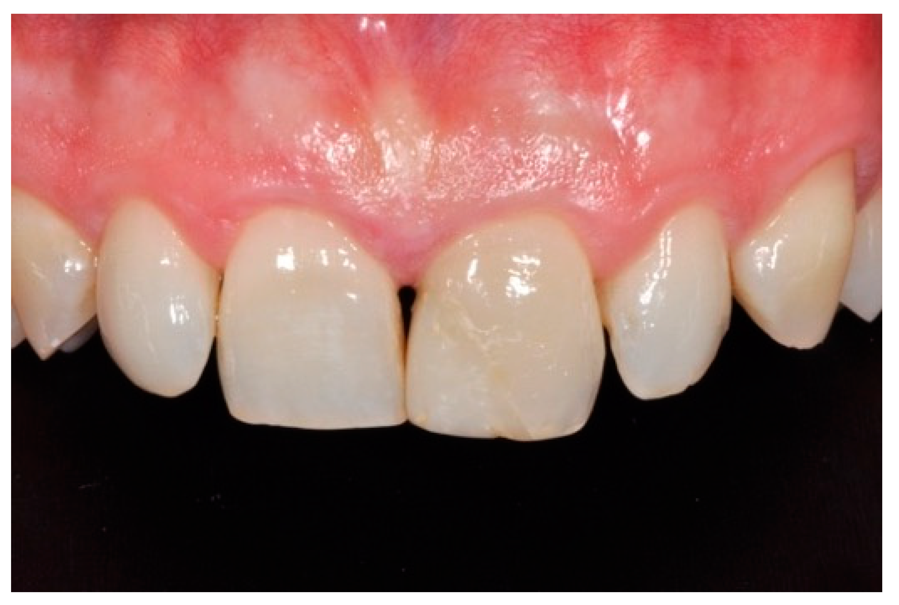 Dentistry 09 00079 g041