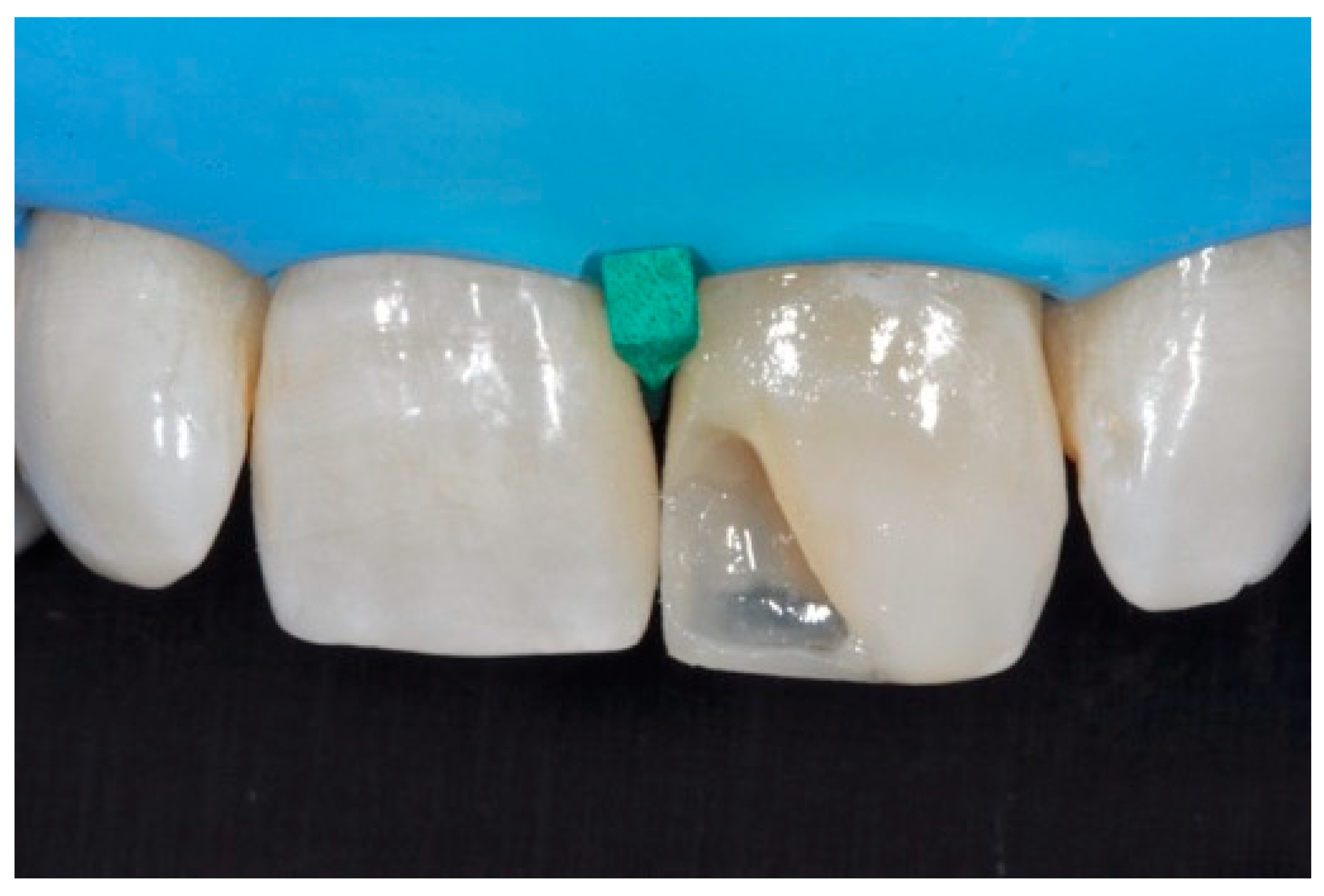 Dentistry 09 00079 g044