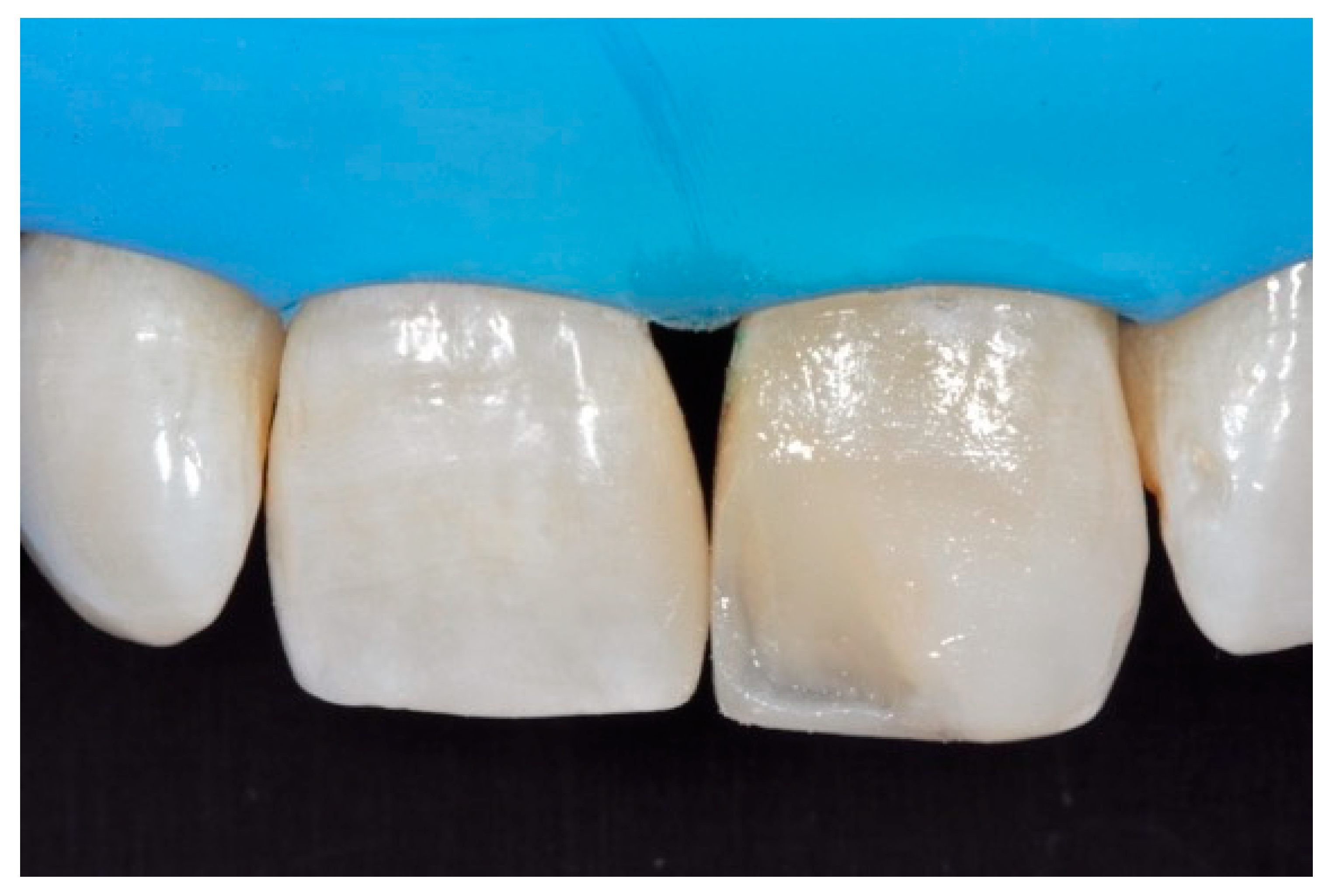 Dentistry 09 00079 g045