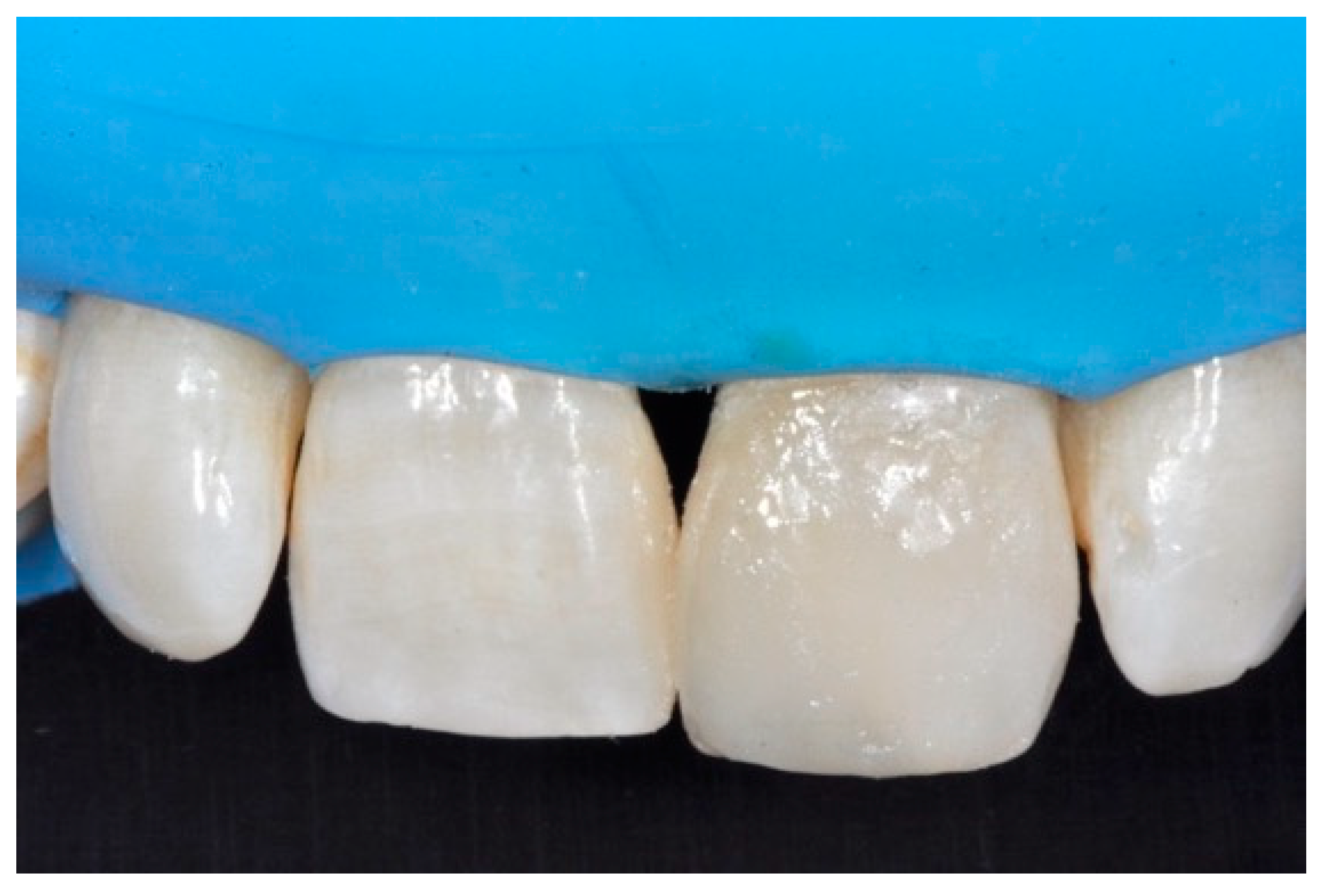 Dentistry 09 00079 g046