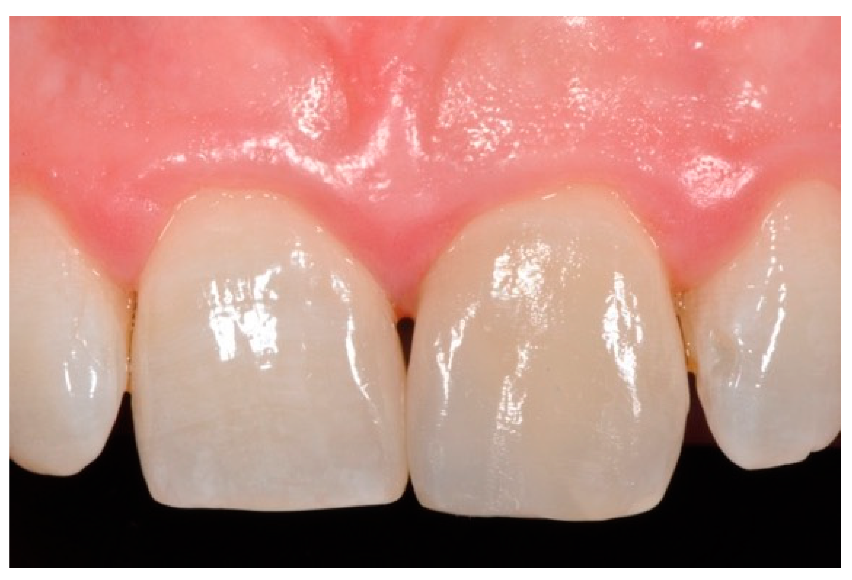 Dentistry 09 00079 g047