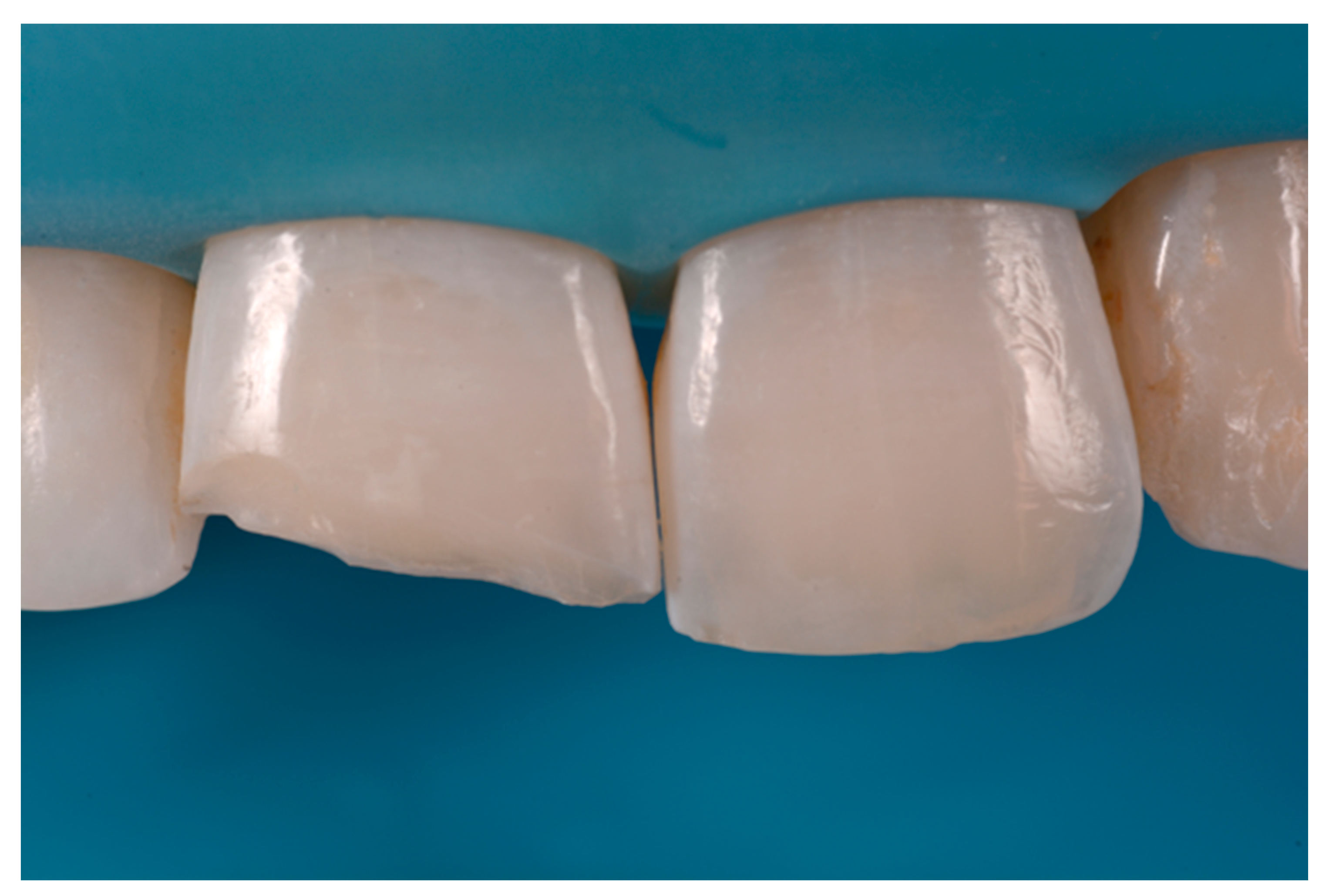 Dentistry 09 00079 g049