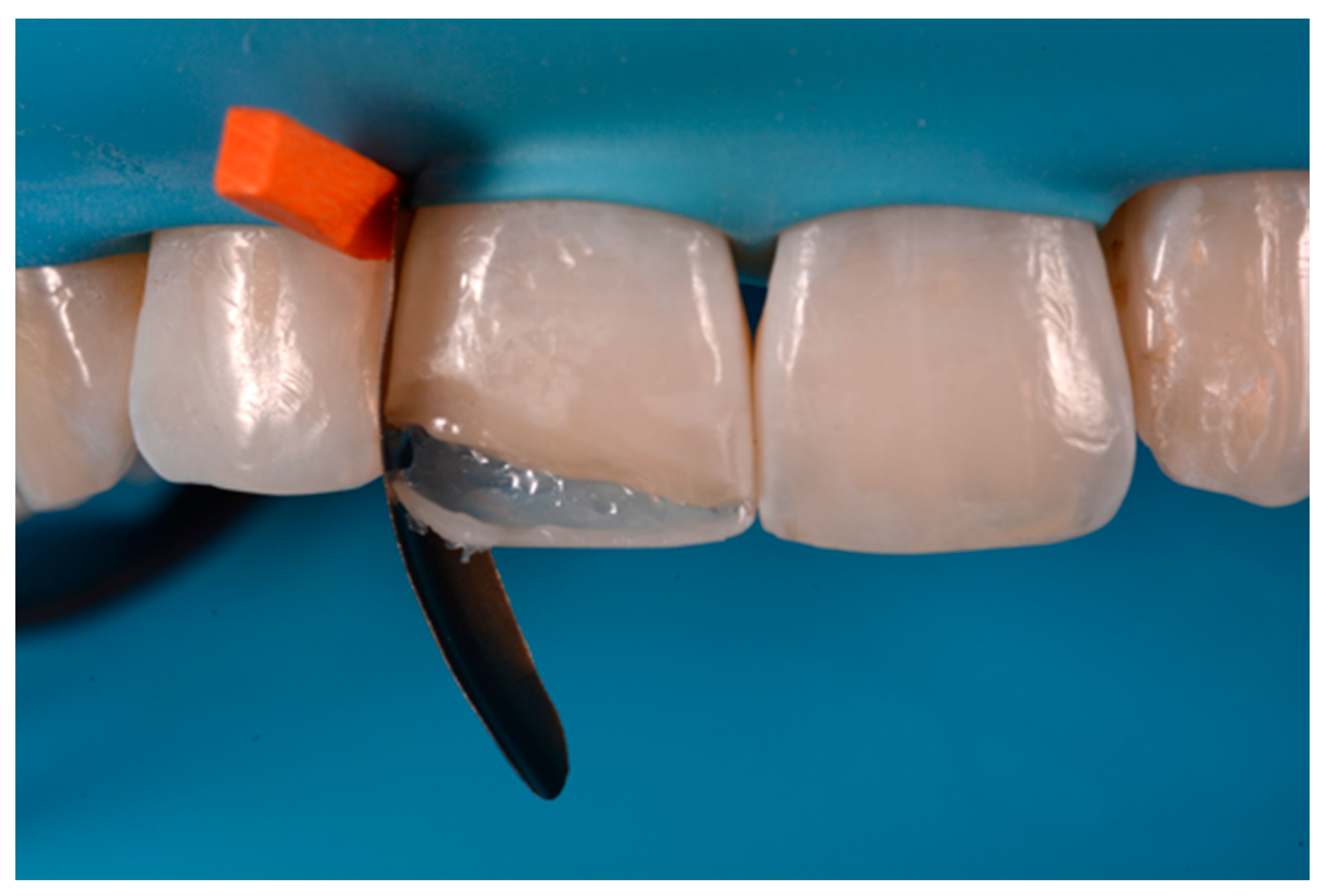 Dentistry 09 00079 g051