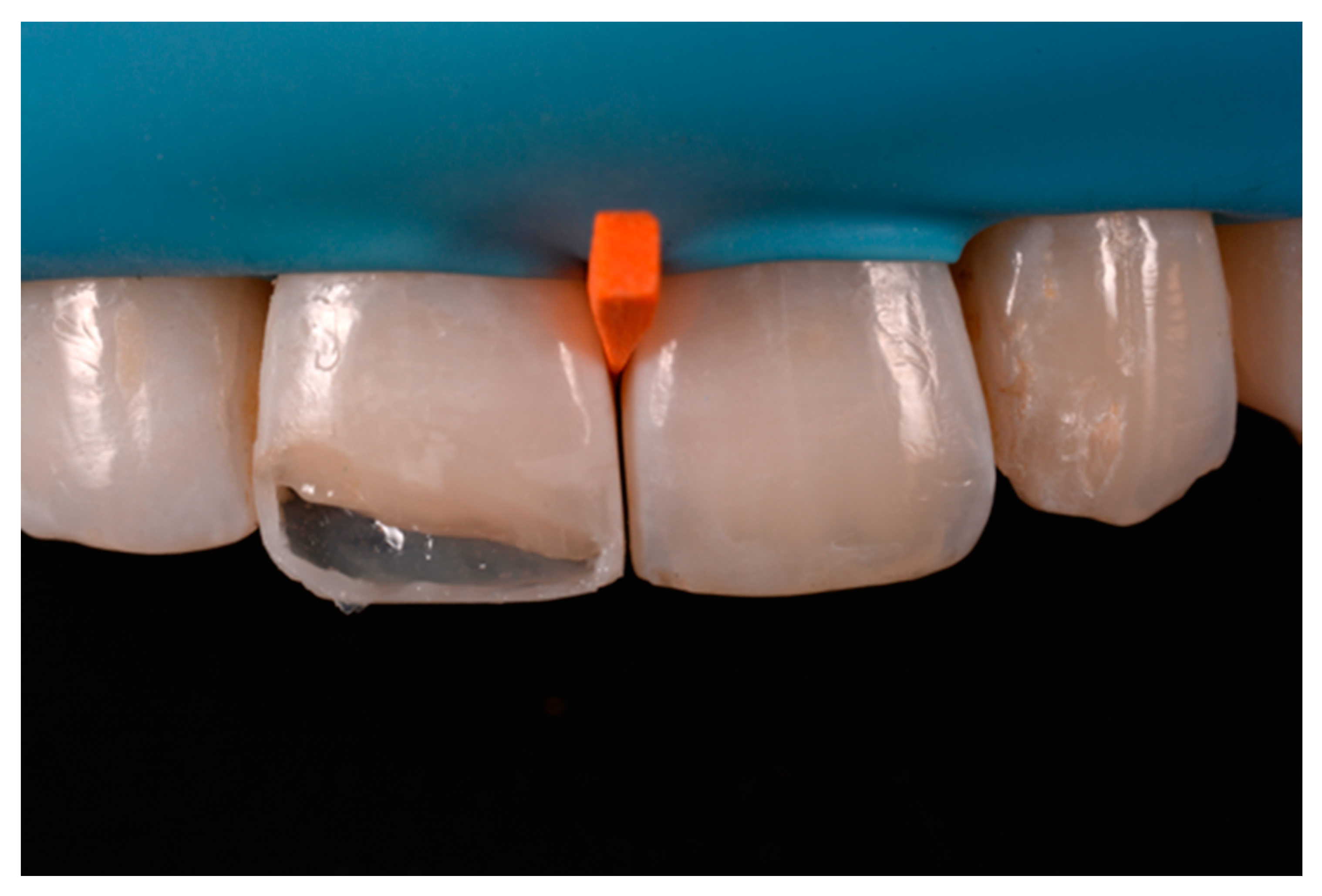 Dentistry 09 00079 g052