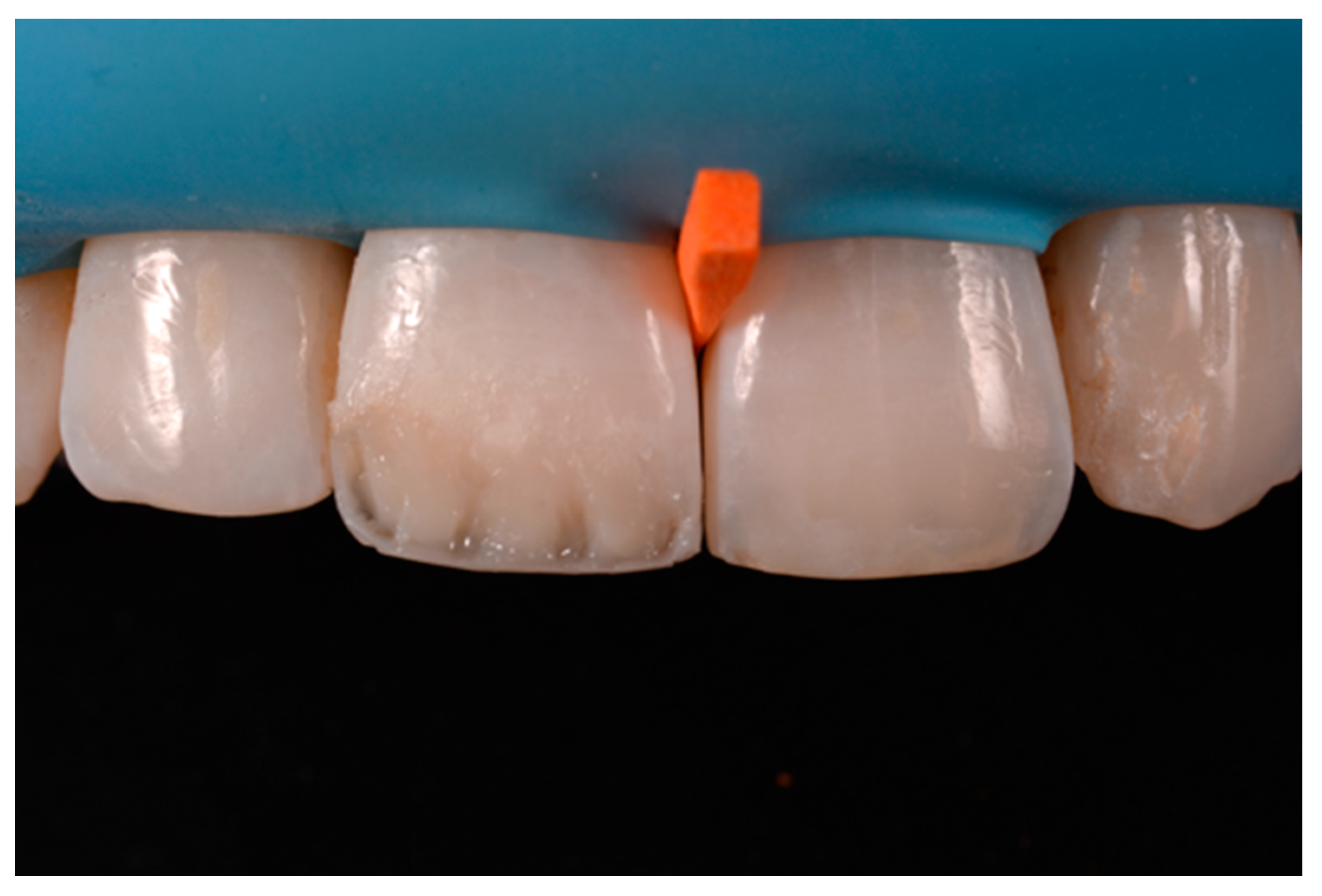 Dentistry 09 00079 g054