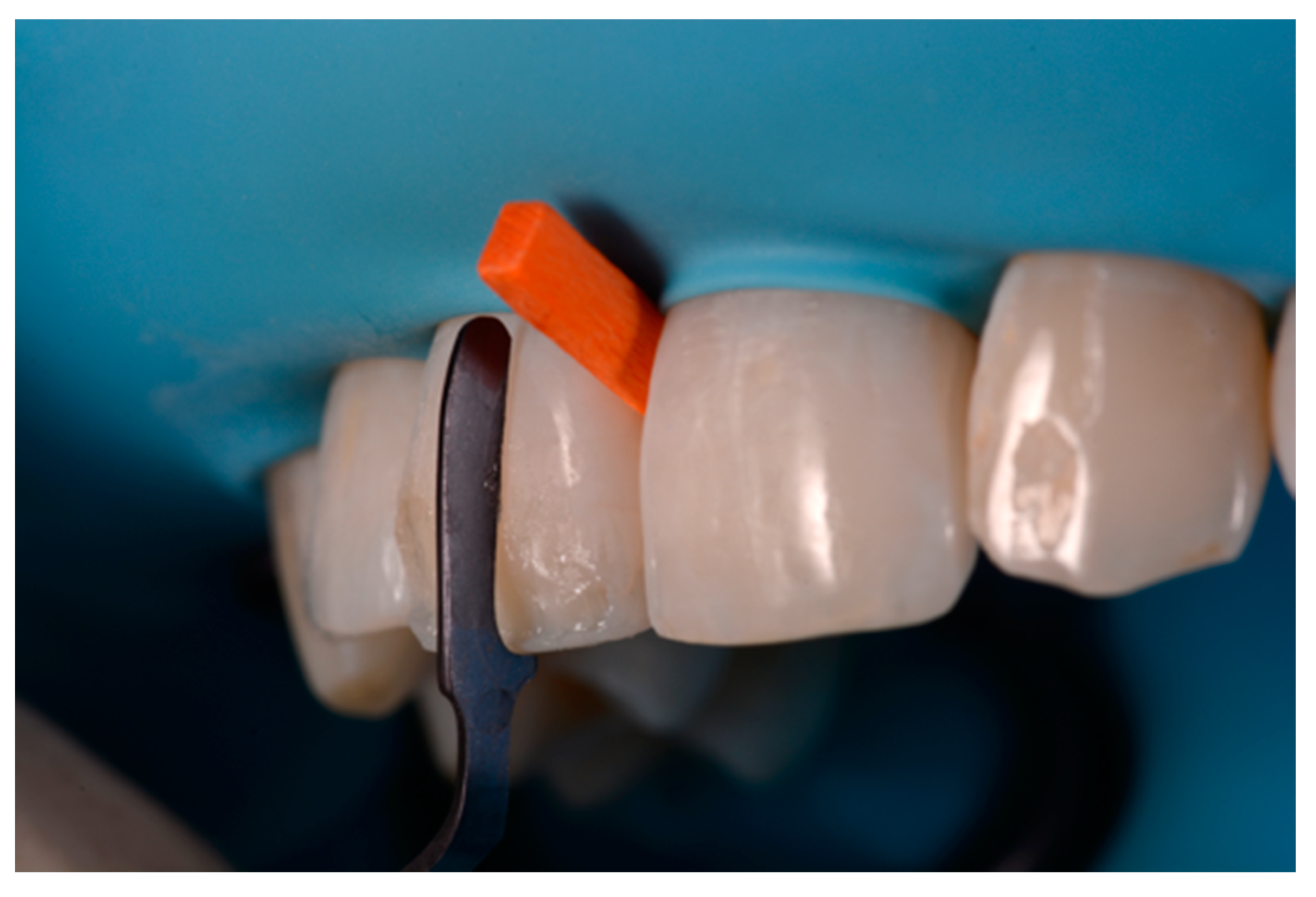 Dentistry 09 00079 g055