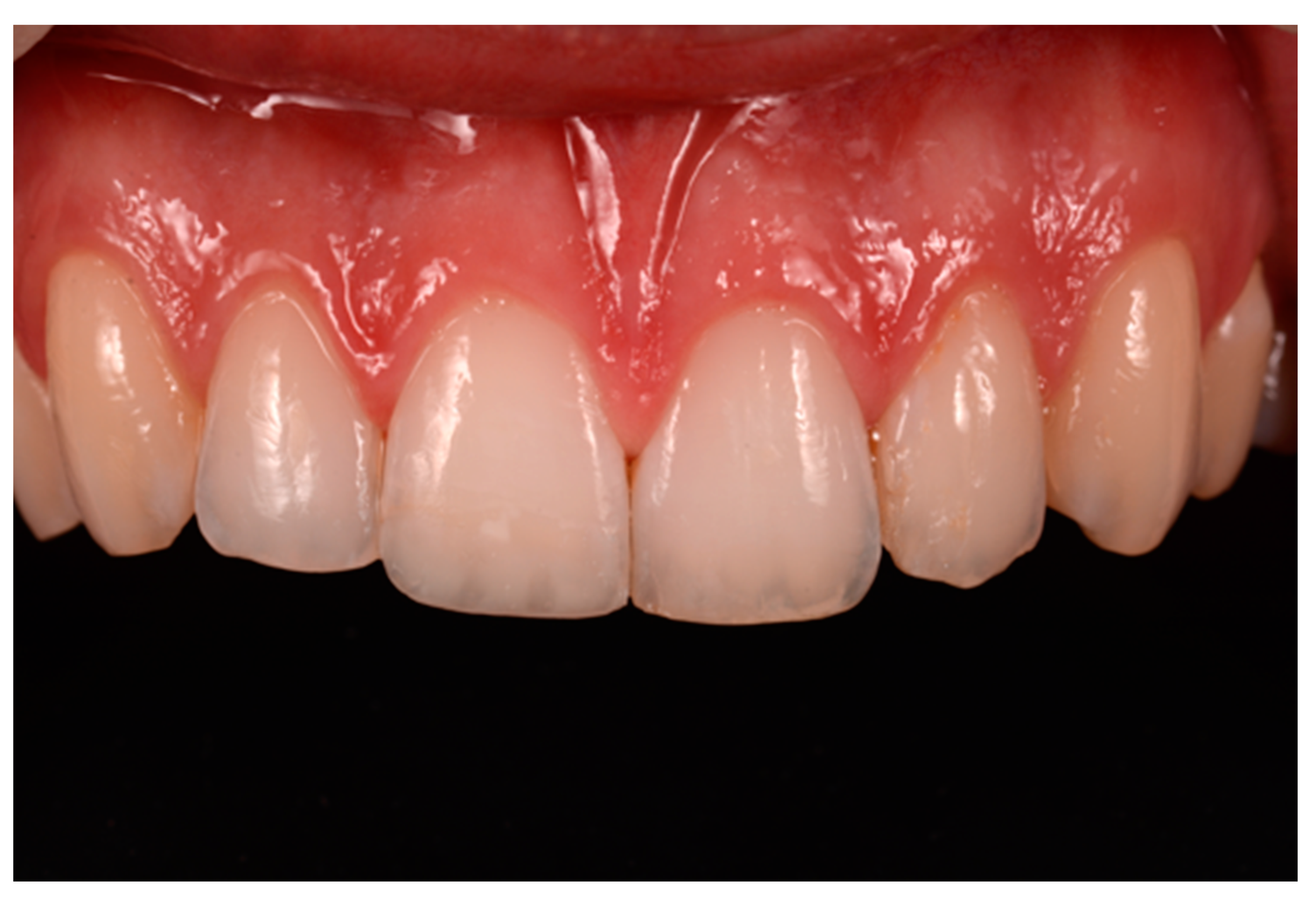 Dentistry 09 00079 g057