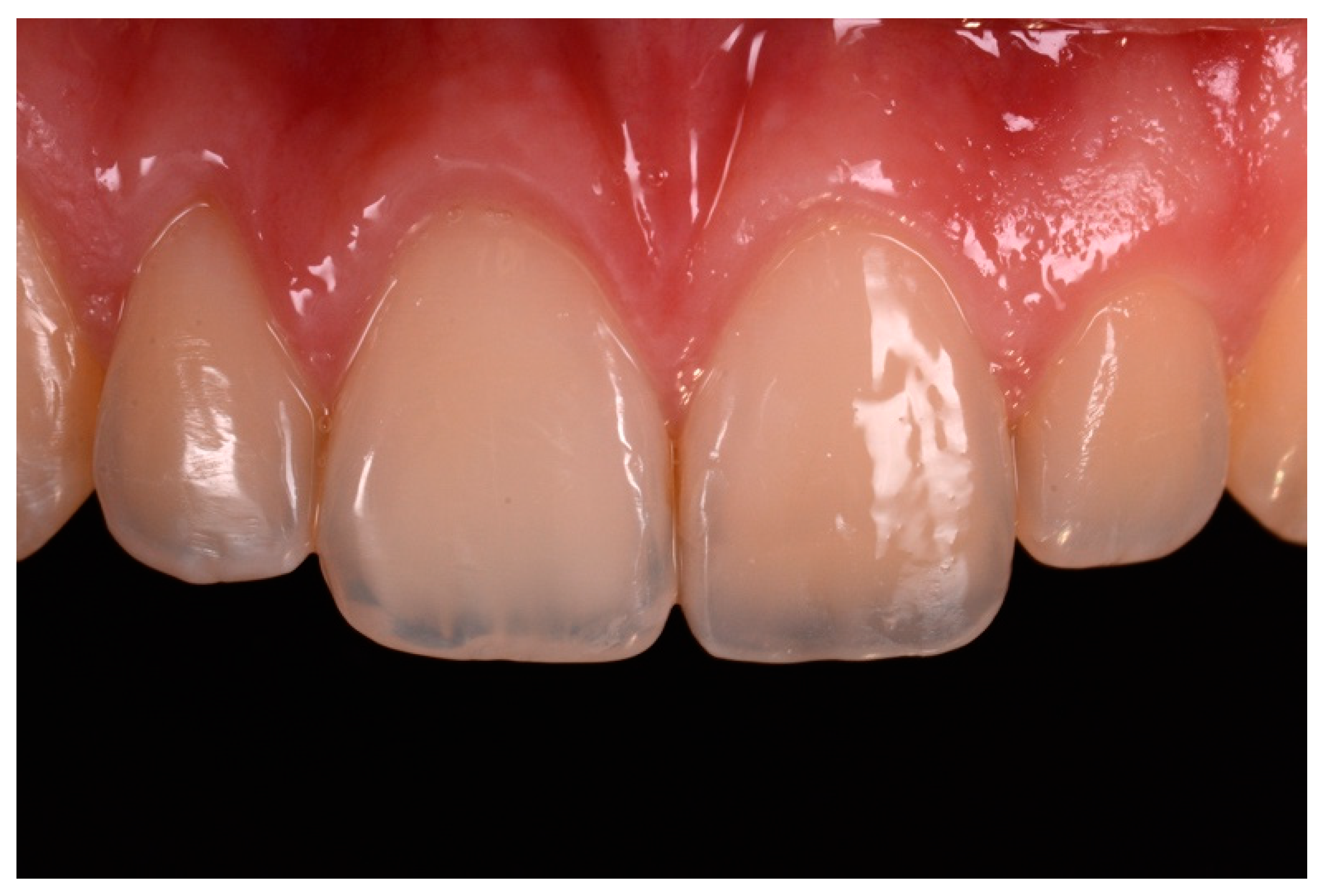 Dentistry 09 00079 g058