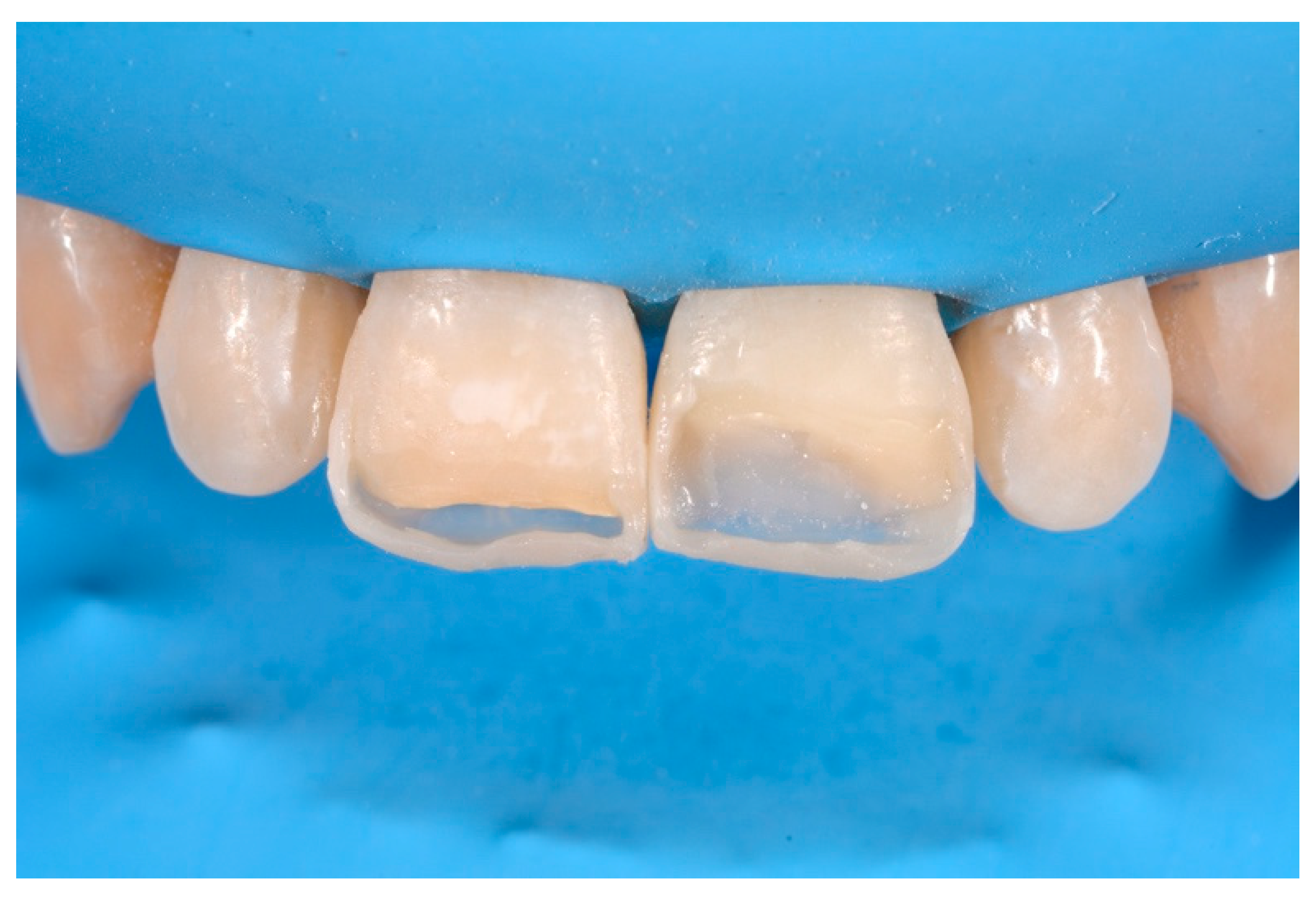 Dentistry 09 00079 g059