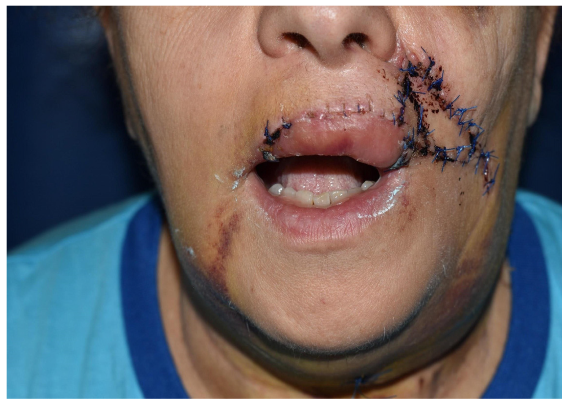 Dentistry 10 00019 g013