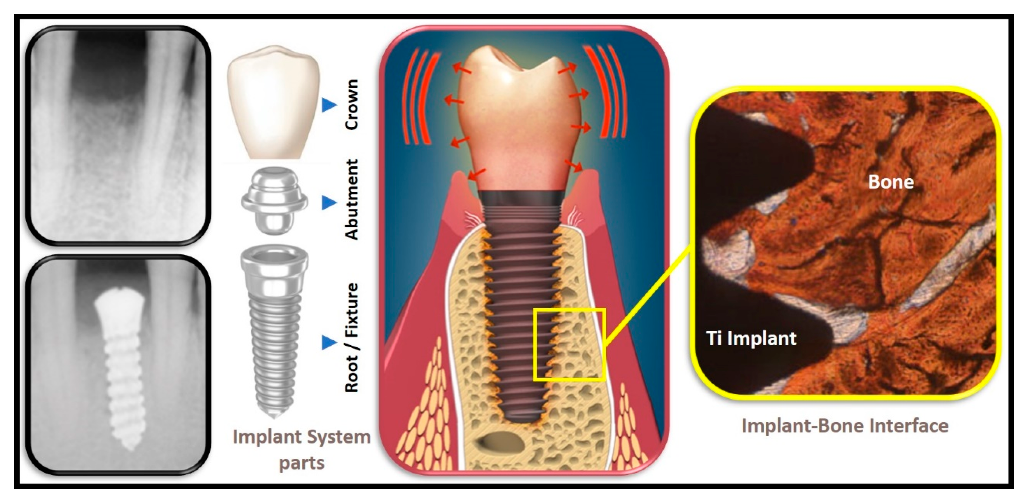 Dentistry 10 00043 g001