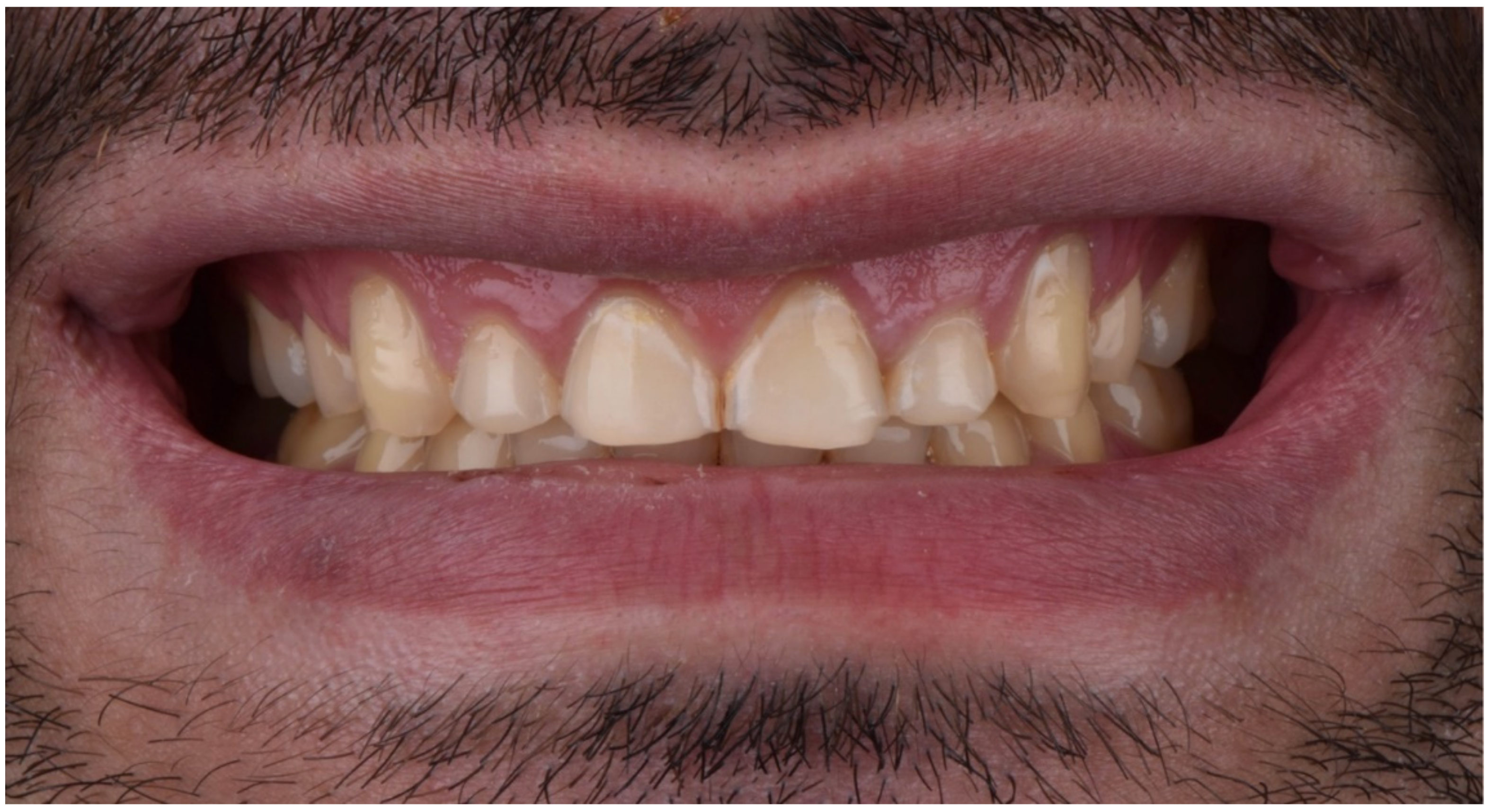 Dentistry 10 00051 g002