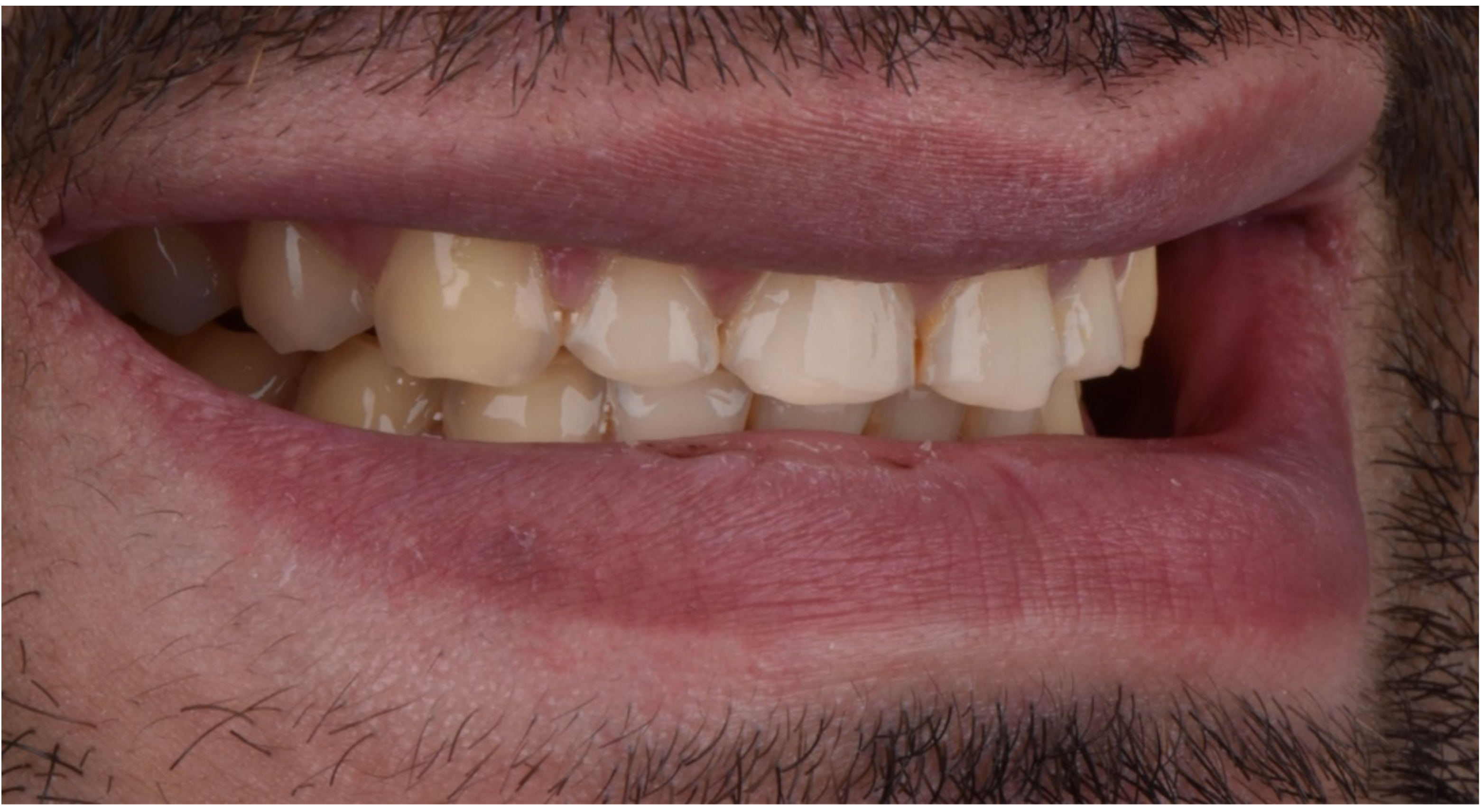 Dentistry 10 00051 g003