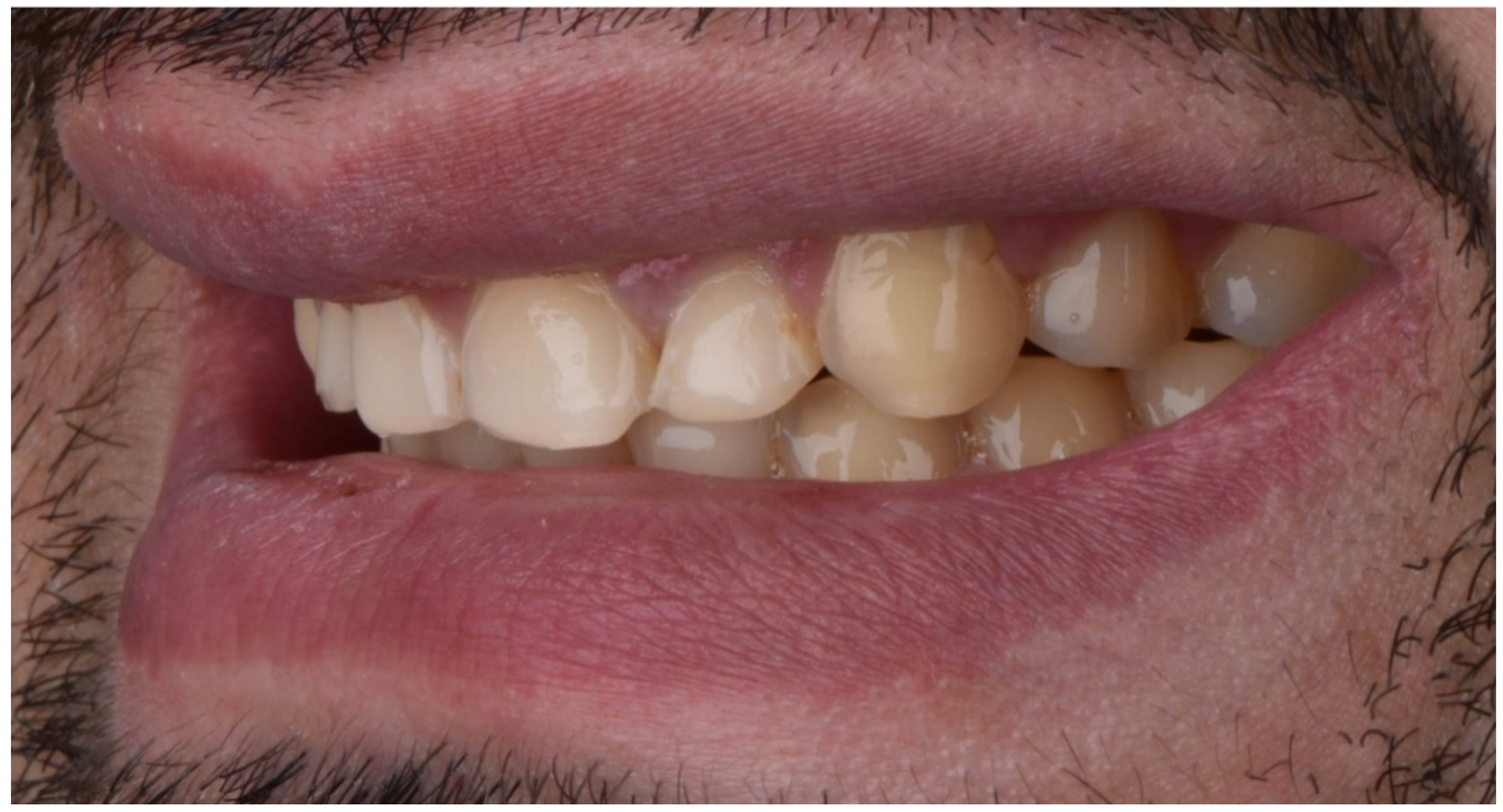 Dentistry 10 00051 g004